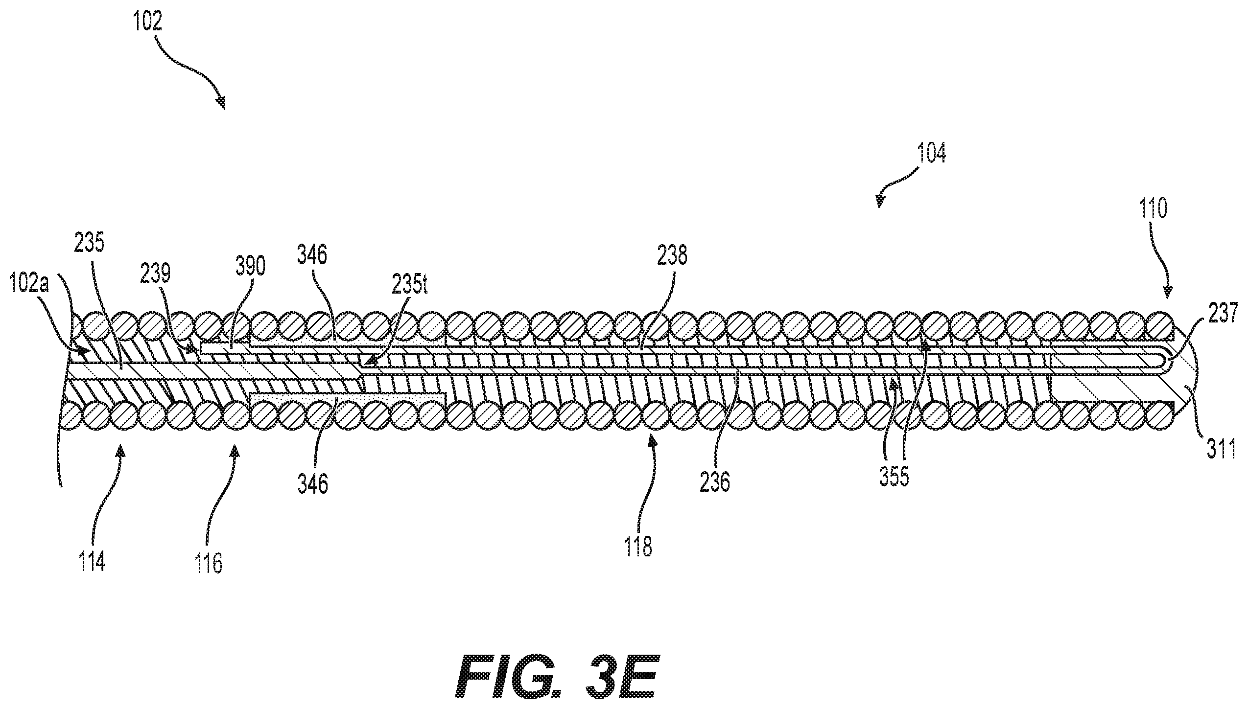 Patent US12564704 Figure 5 – Intraluminal device with looped core wire