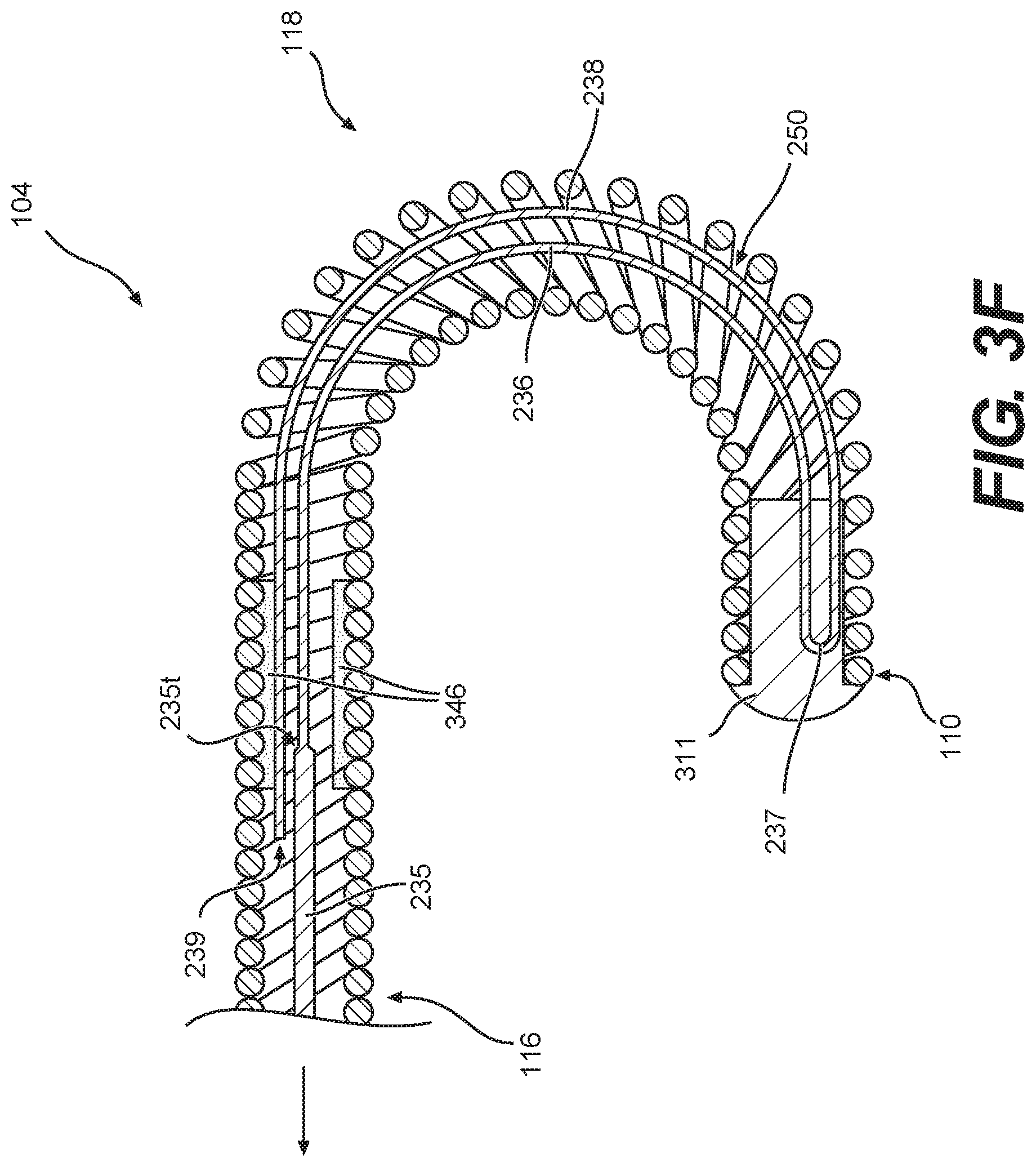 Patent US12564704 Figure 6 – Intraluminal device with looped core wire