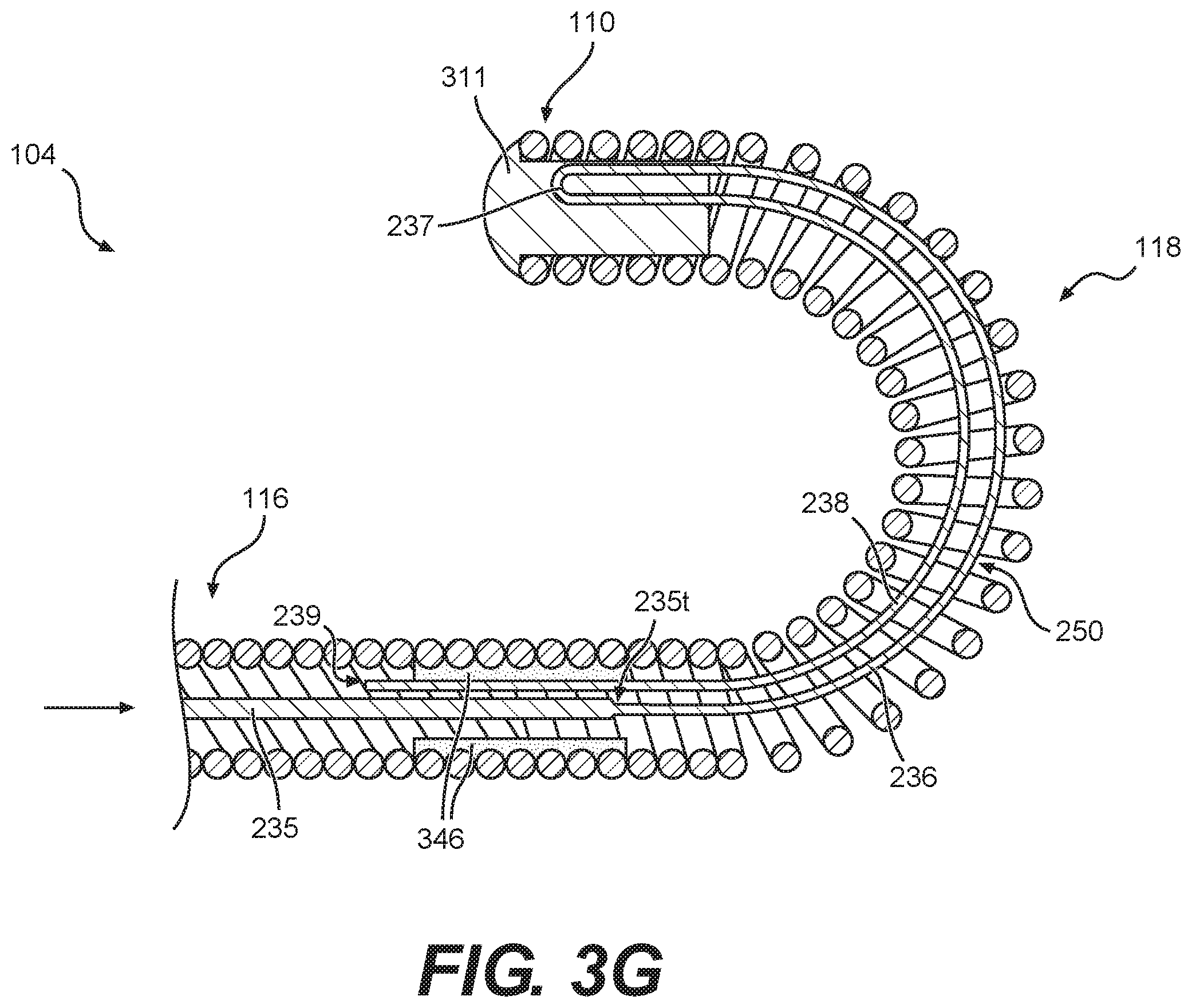 Patent US12564704 Figure 7 – Intraluminal device with looped core wire