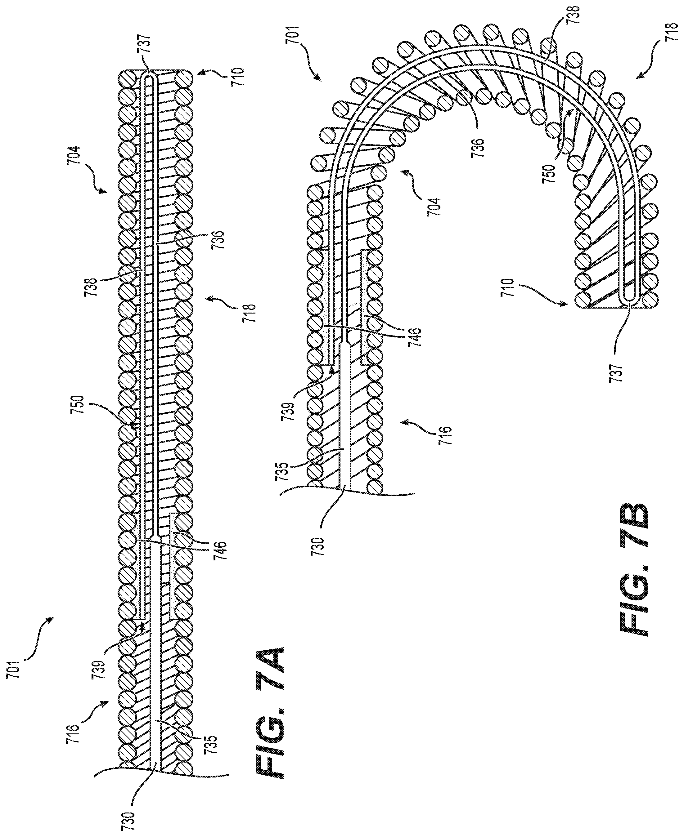 Patent US12564704 Figure 11 – Intraluminal device with looped core wire