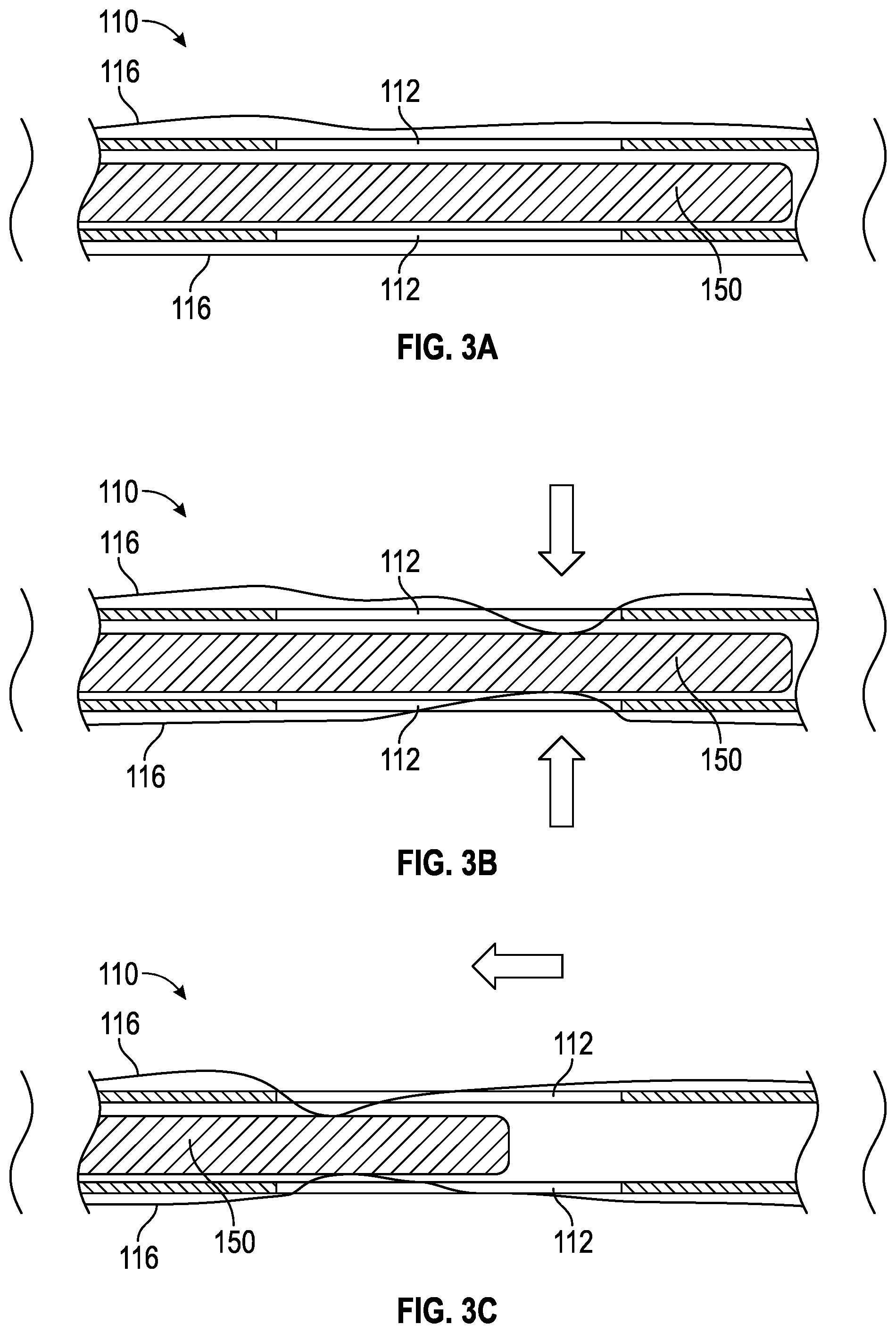 Patent US12564705 Figure 3 – Splitable needle and dilator catheter placement device and associated methods