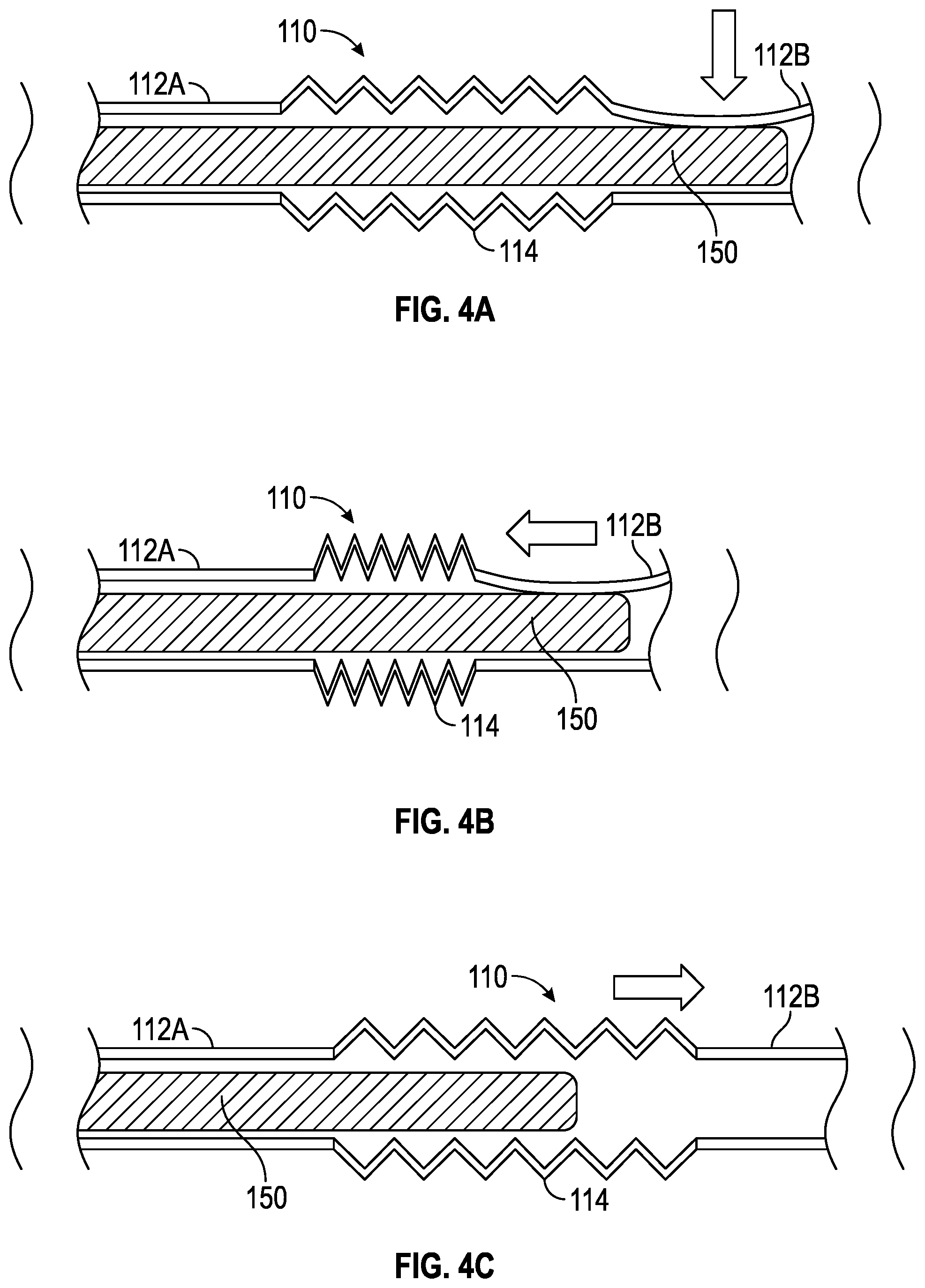 Patent US12564705 Figure 4 – Splitable needle and dilator catheter placement device and associated methods