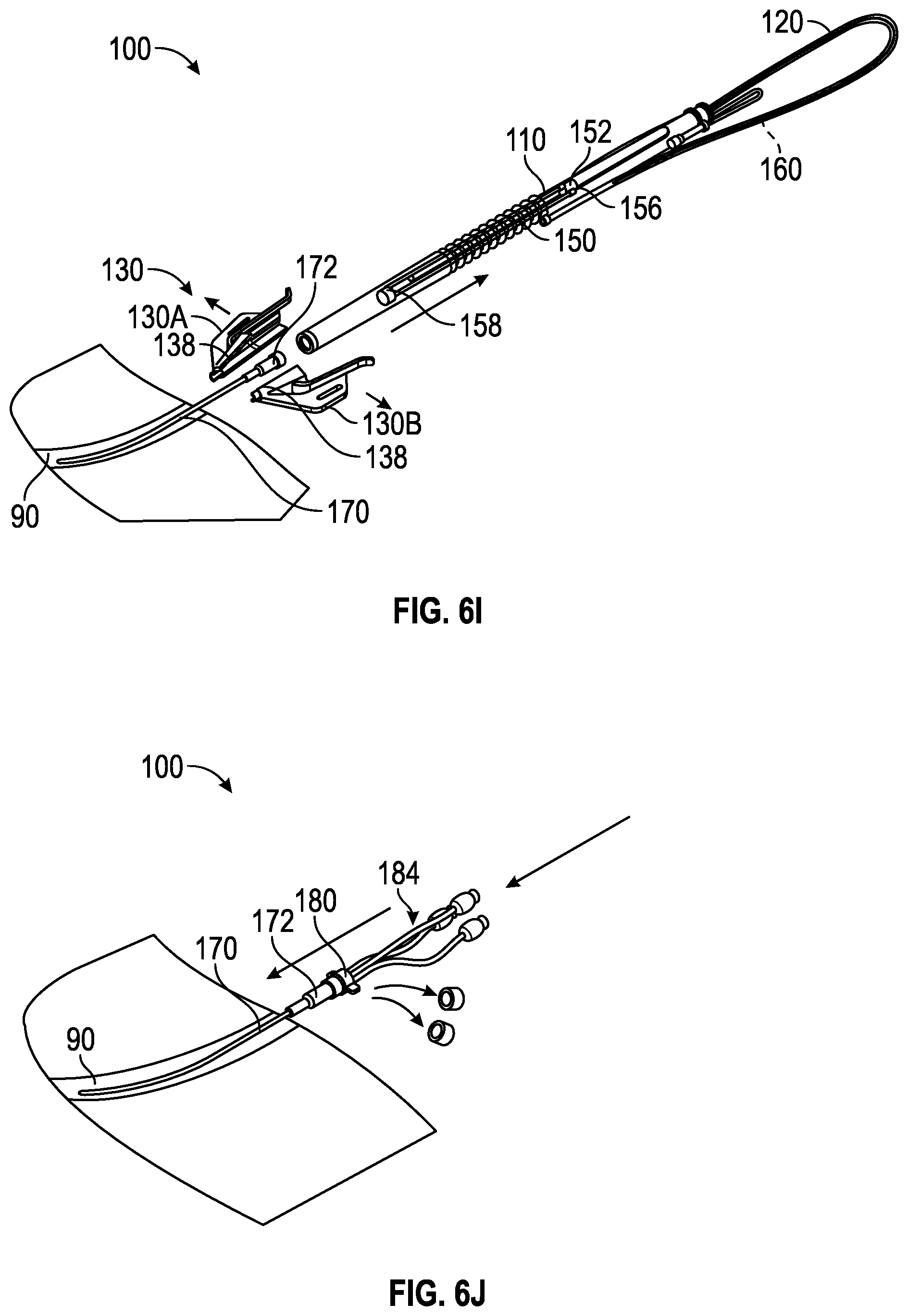Patent US12564705 Figure 11 – Splitable needle and dilator catheter placement device and associated methods