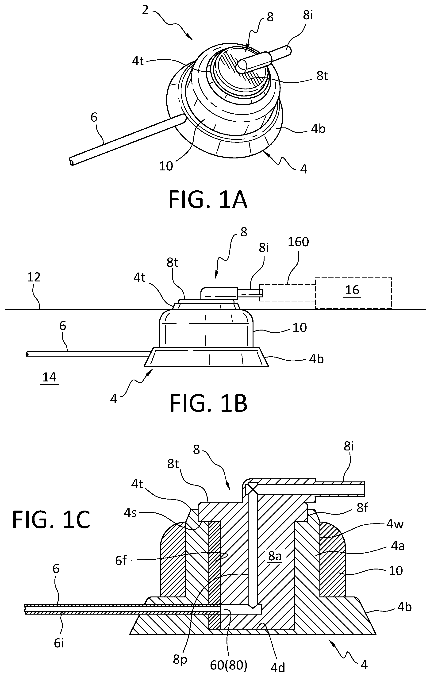 Patent US12564709 Figure 1 – Port adapted to be frequently accessed