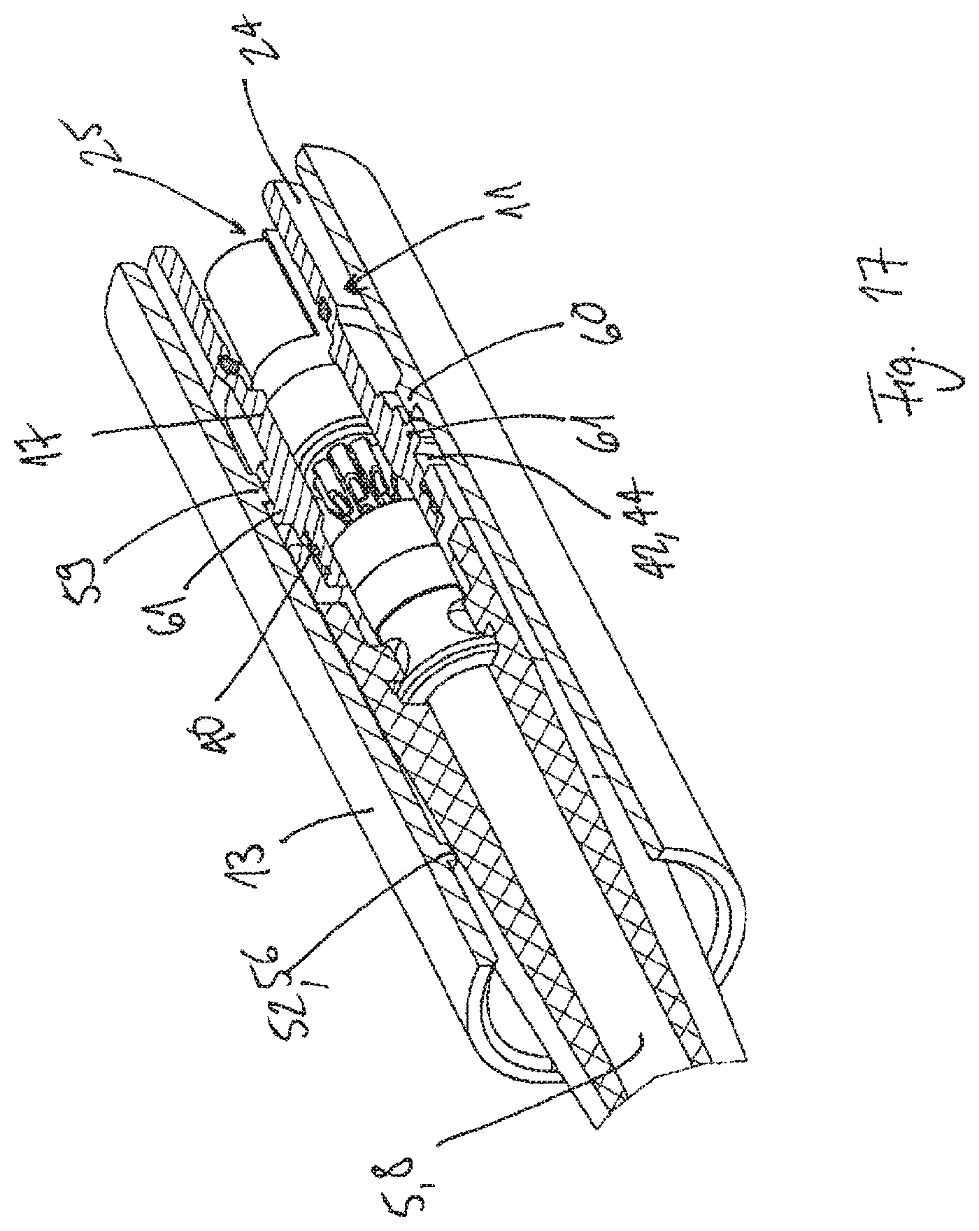 Patent US12564710 Figure 12 – System for securing a releasable connection between two elements