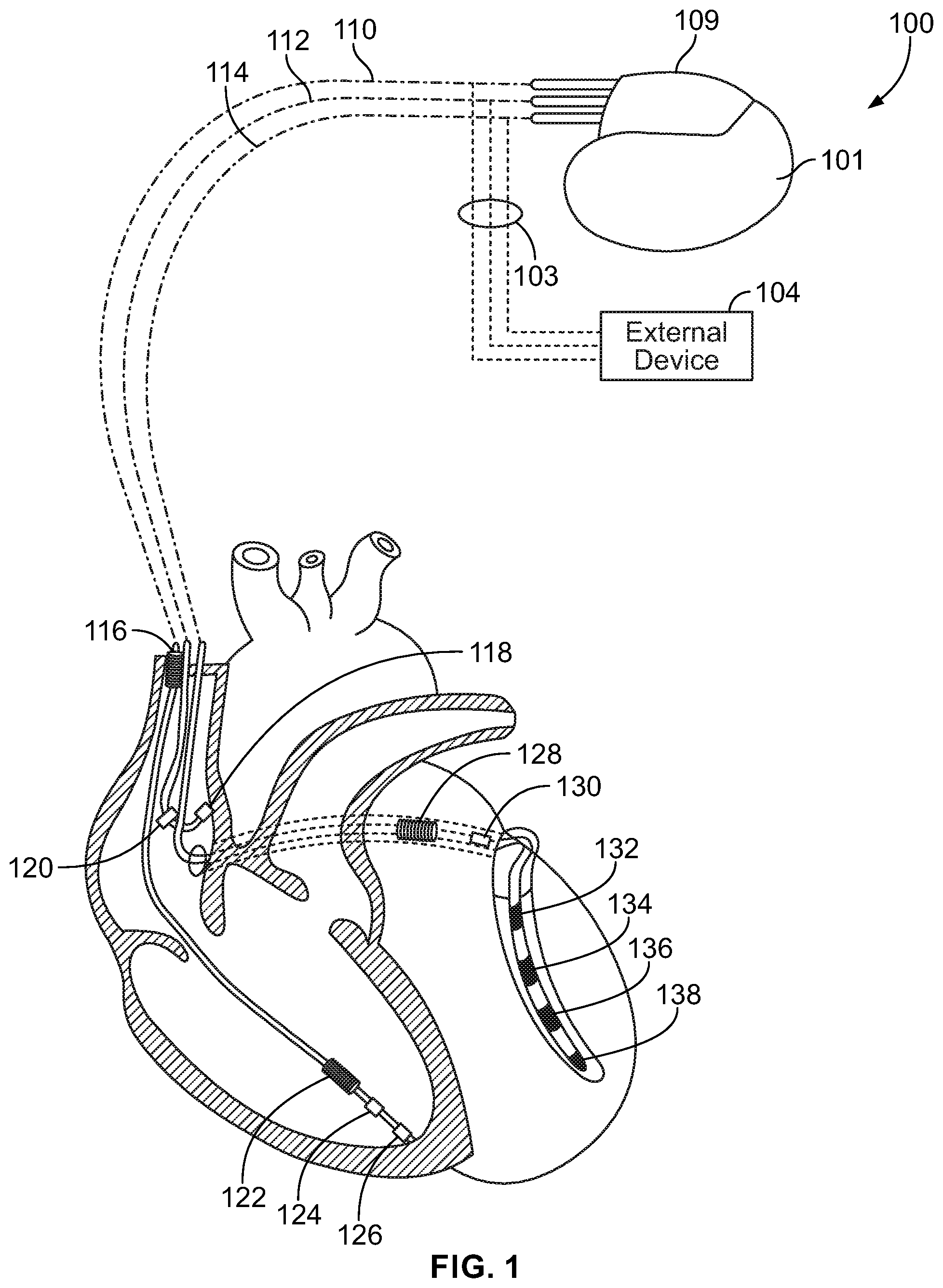 Patent US12564711 Figure 1 – Method and device for managing processing activity patterns