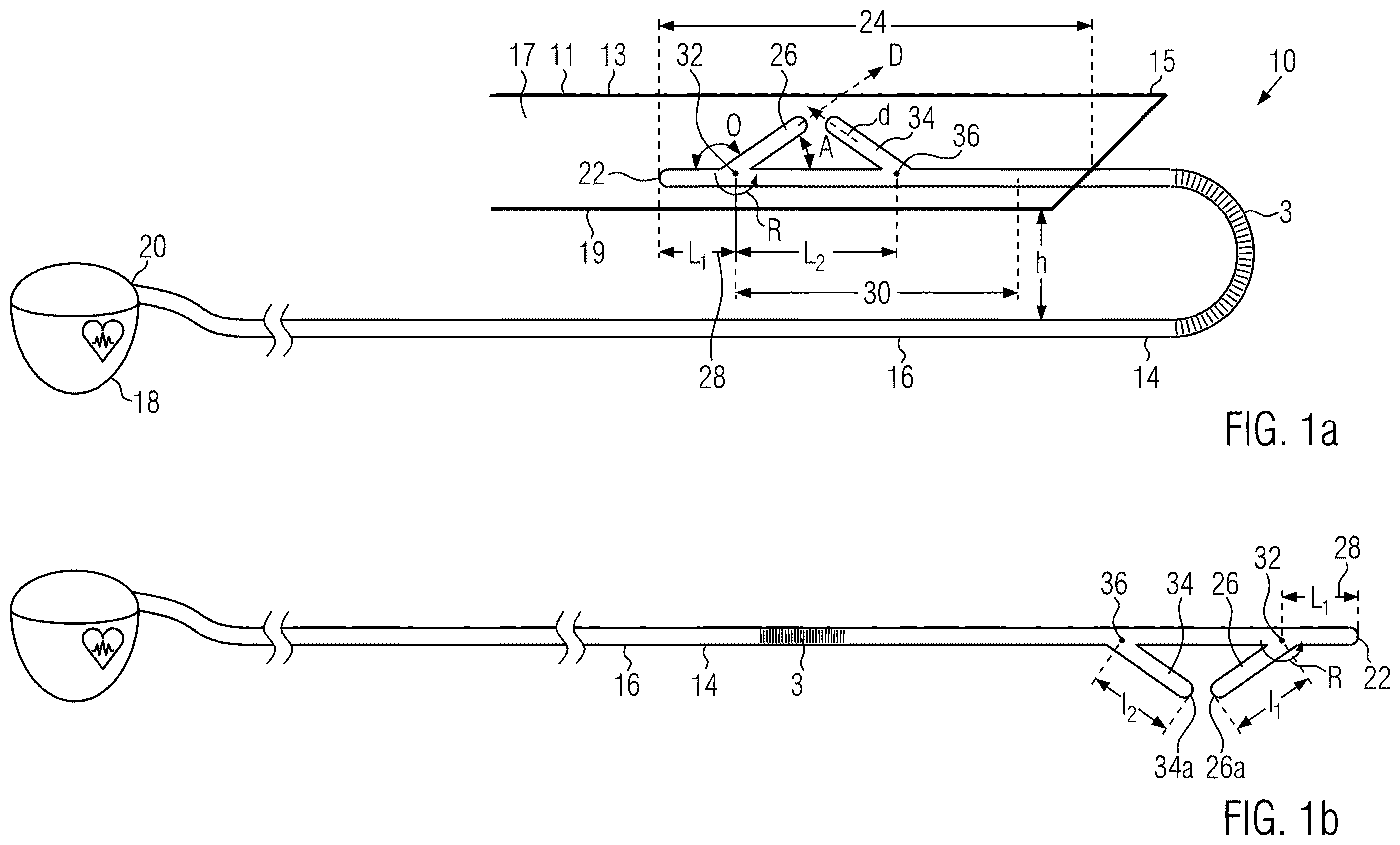 Patent US12564713 — Assembly of an implanting accessory and a flexible implantable stimulation lead — Figure 1