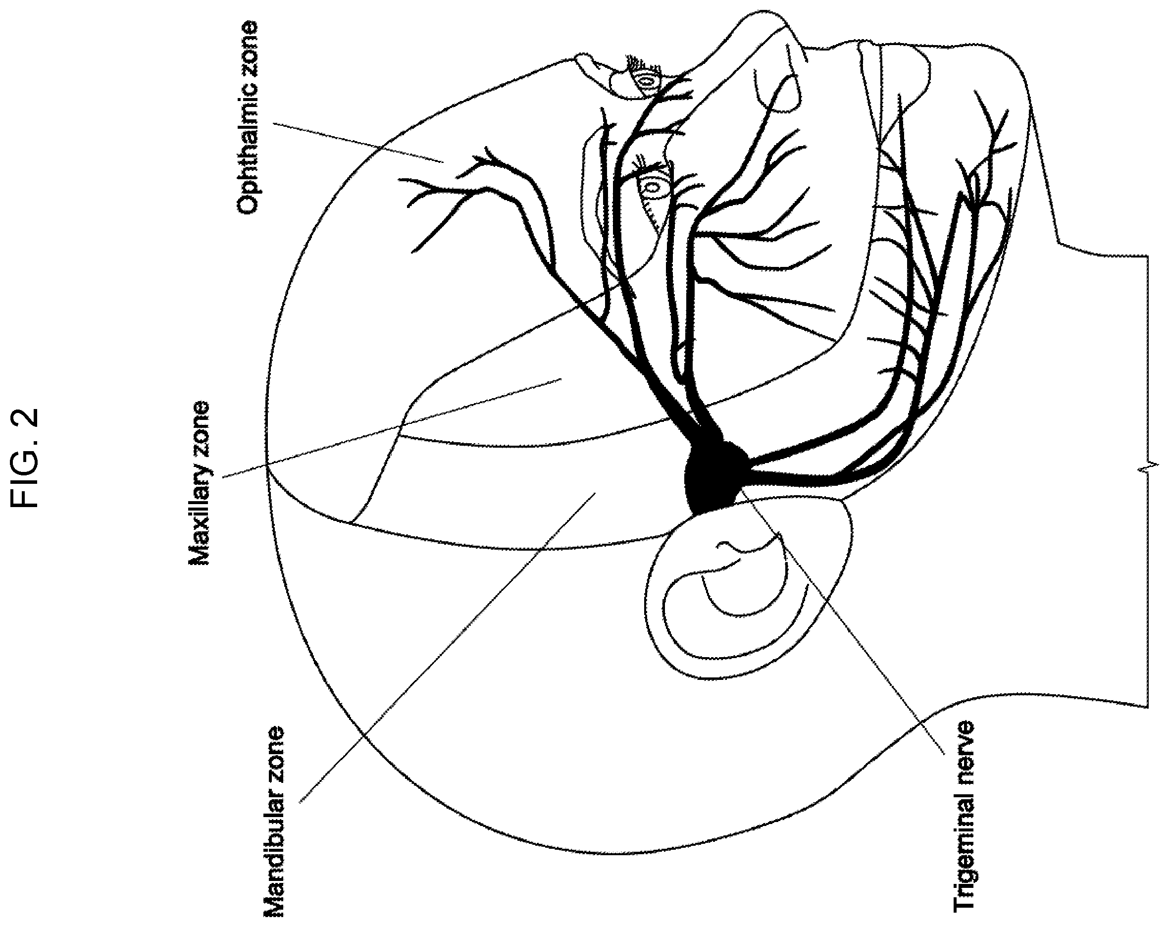 Patent US12564715 Figure 4 – TMJ treatment device with adaptive circuit