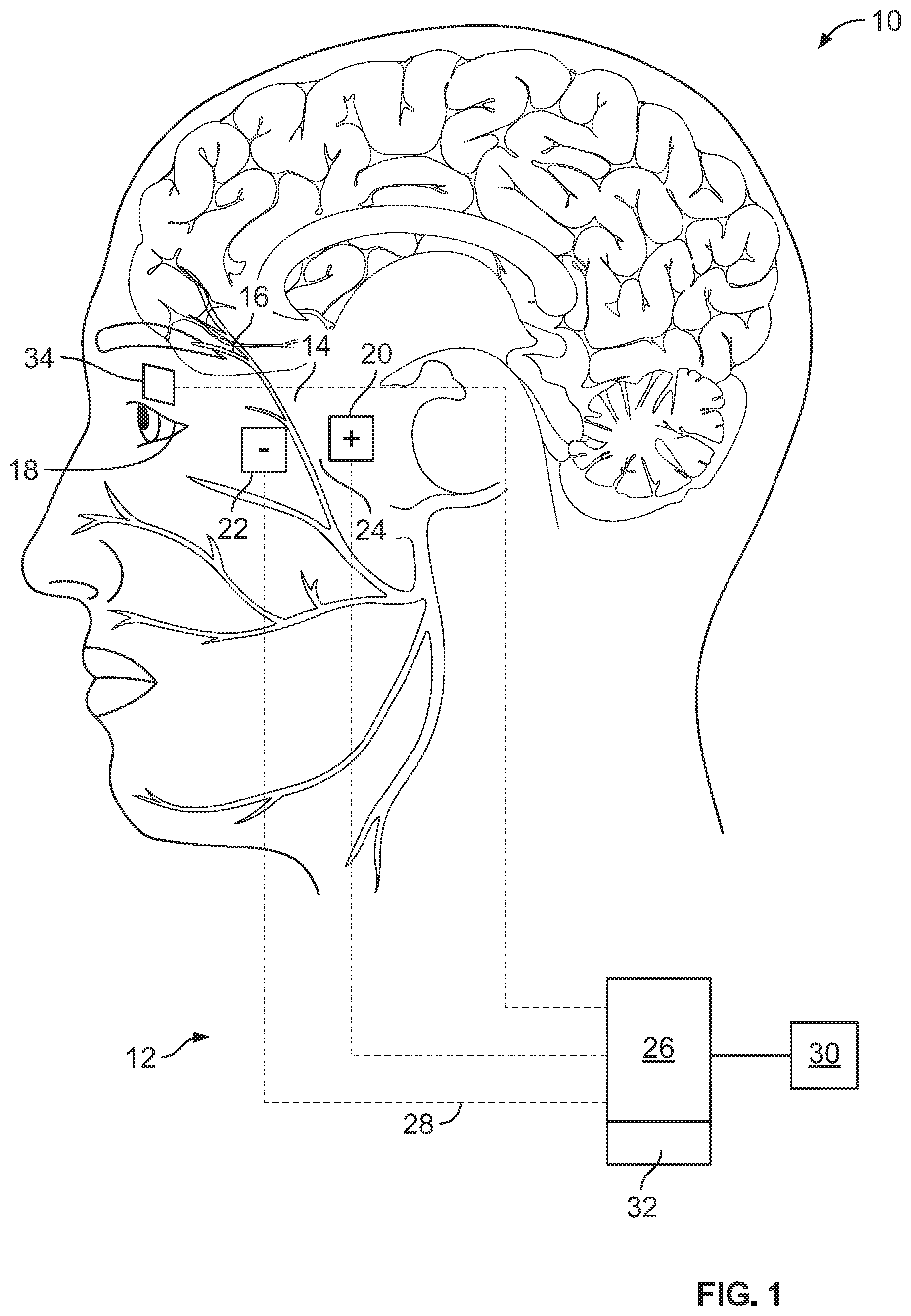 Patent US12564716 — Tonic eyelid closure and blink pacing device and method — Figure 1