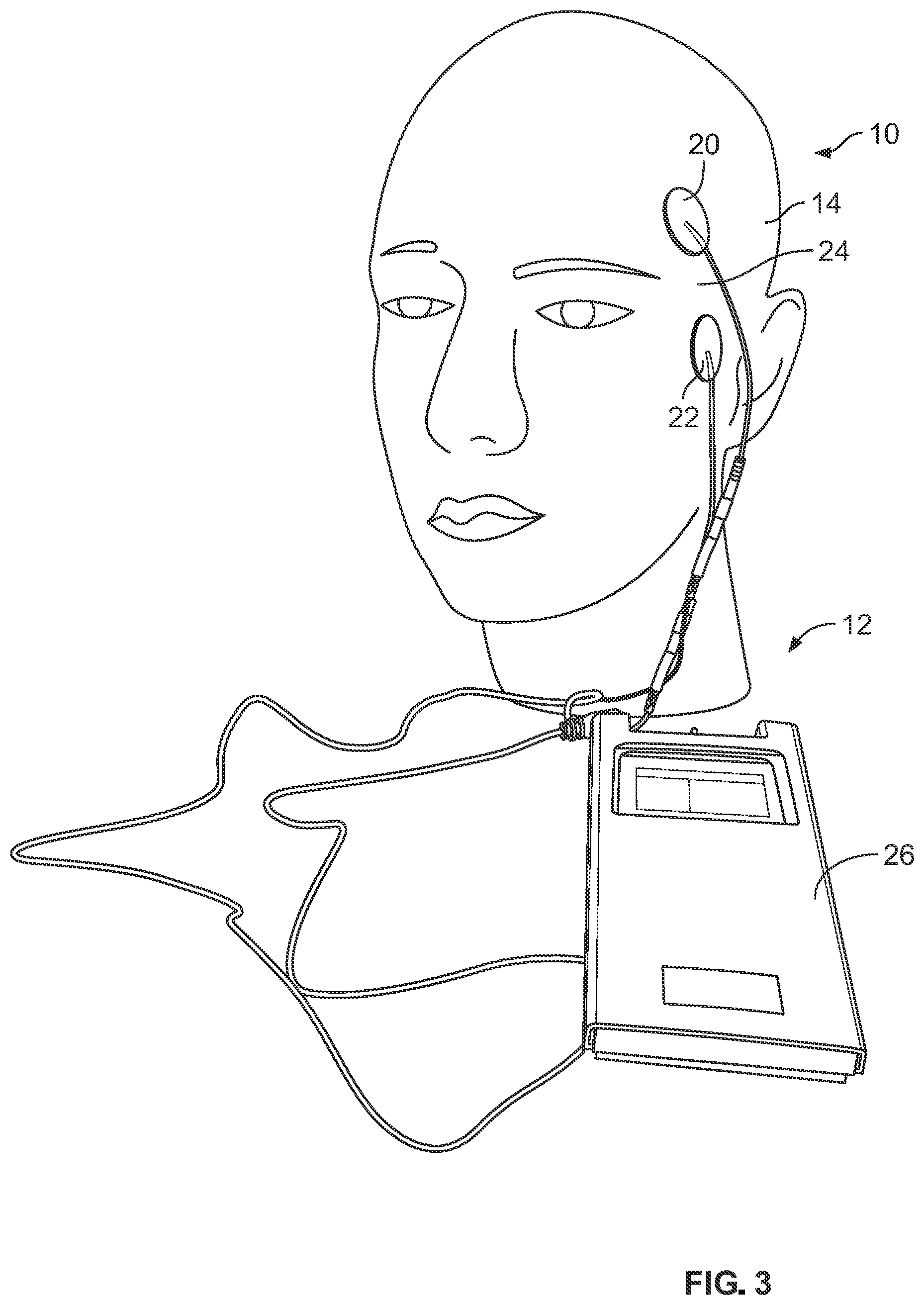 Patent US12564716 Figure 3 – Tonic eyelid closure and blink pacing device and method