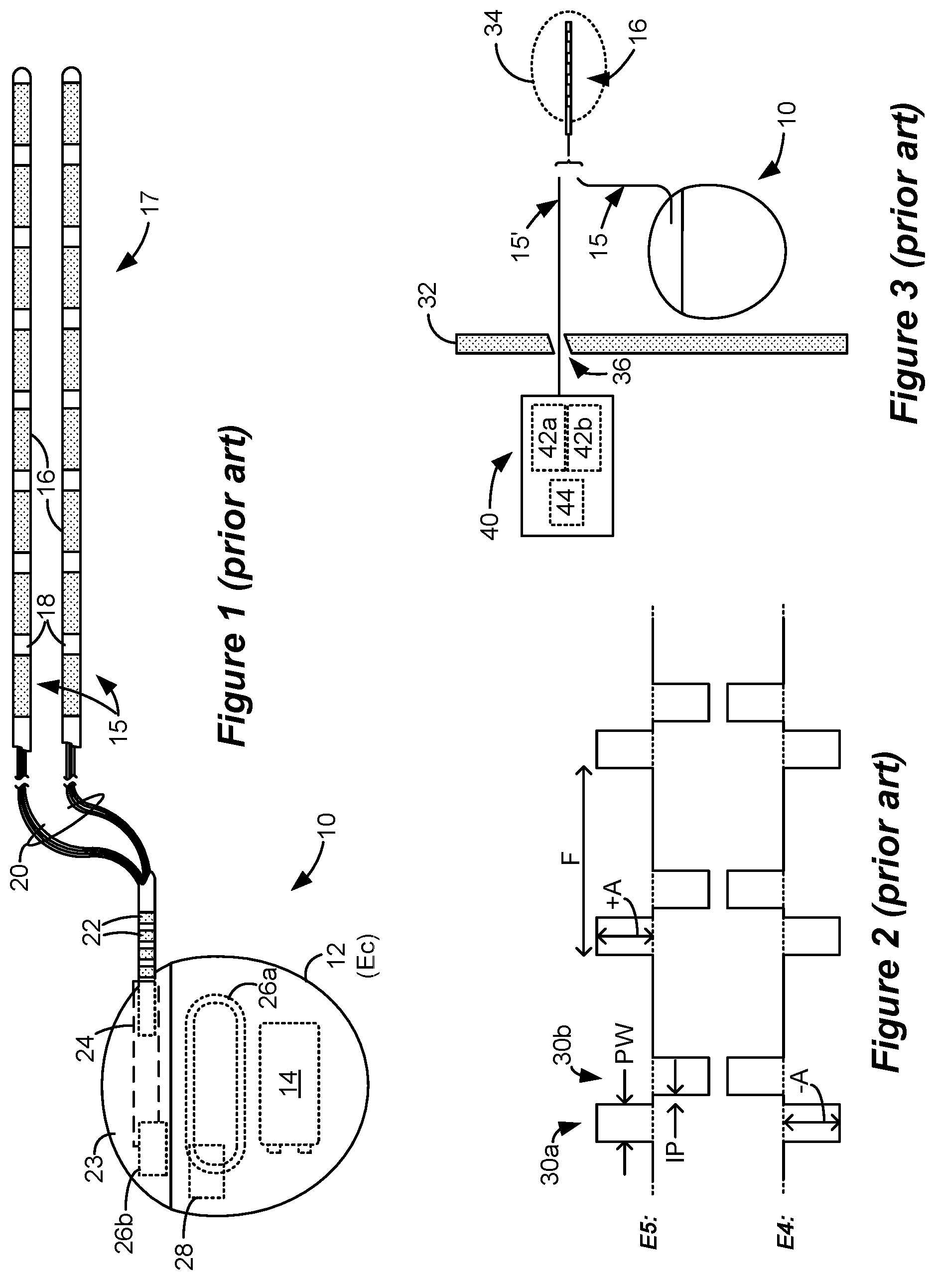 Patent US12564717 Figure 1 – Paresthesia-free spinal cord stimulation occurring at lower frequencies involving perception threshold determinations