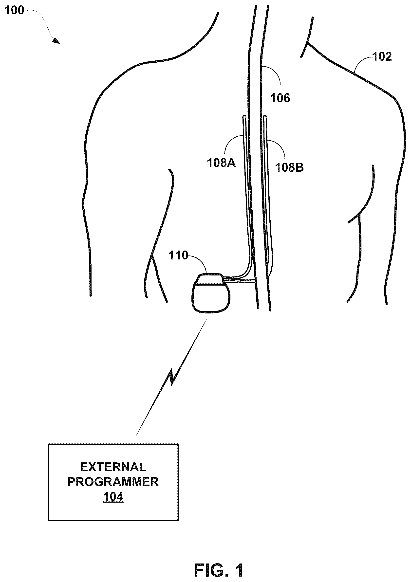 Patent US12564719 Figure 1 – Selection of parameters for electrical stimulation