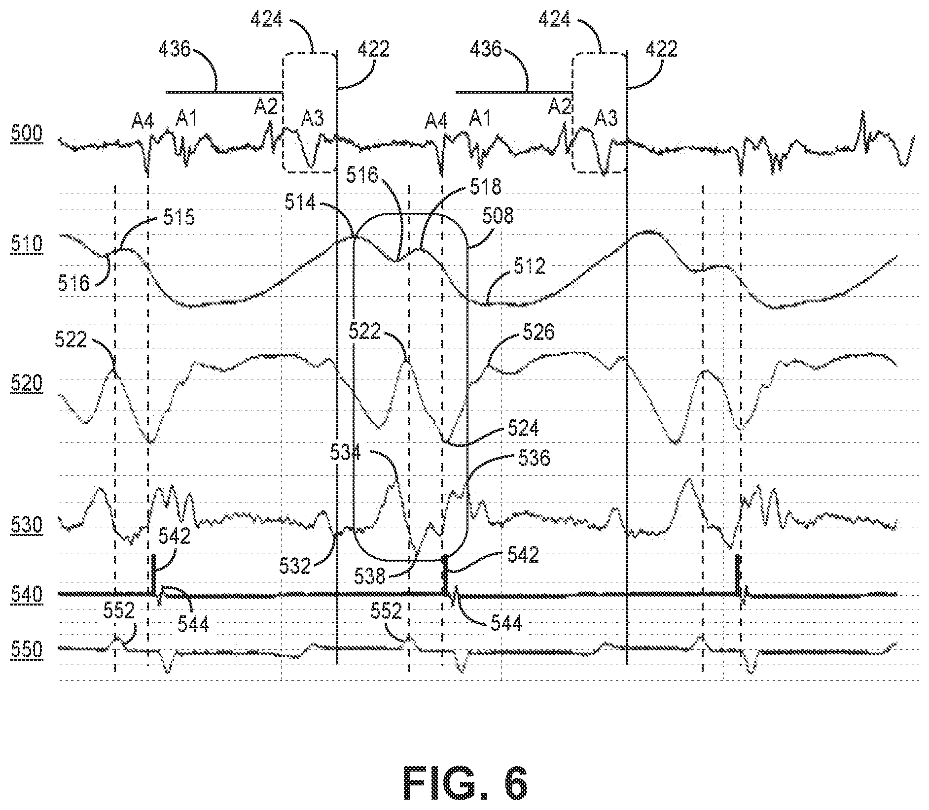 Patent US12564720 Figure 5 – Method and apparatus for atrial event detection