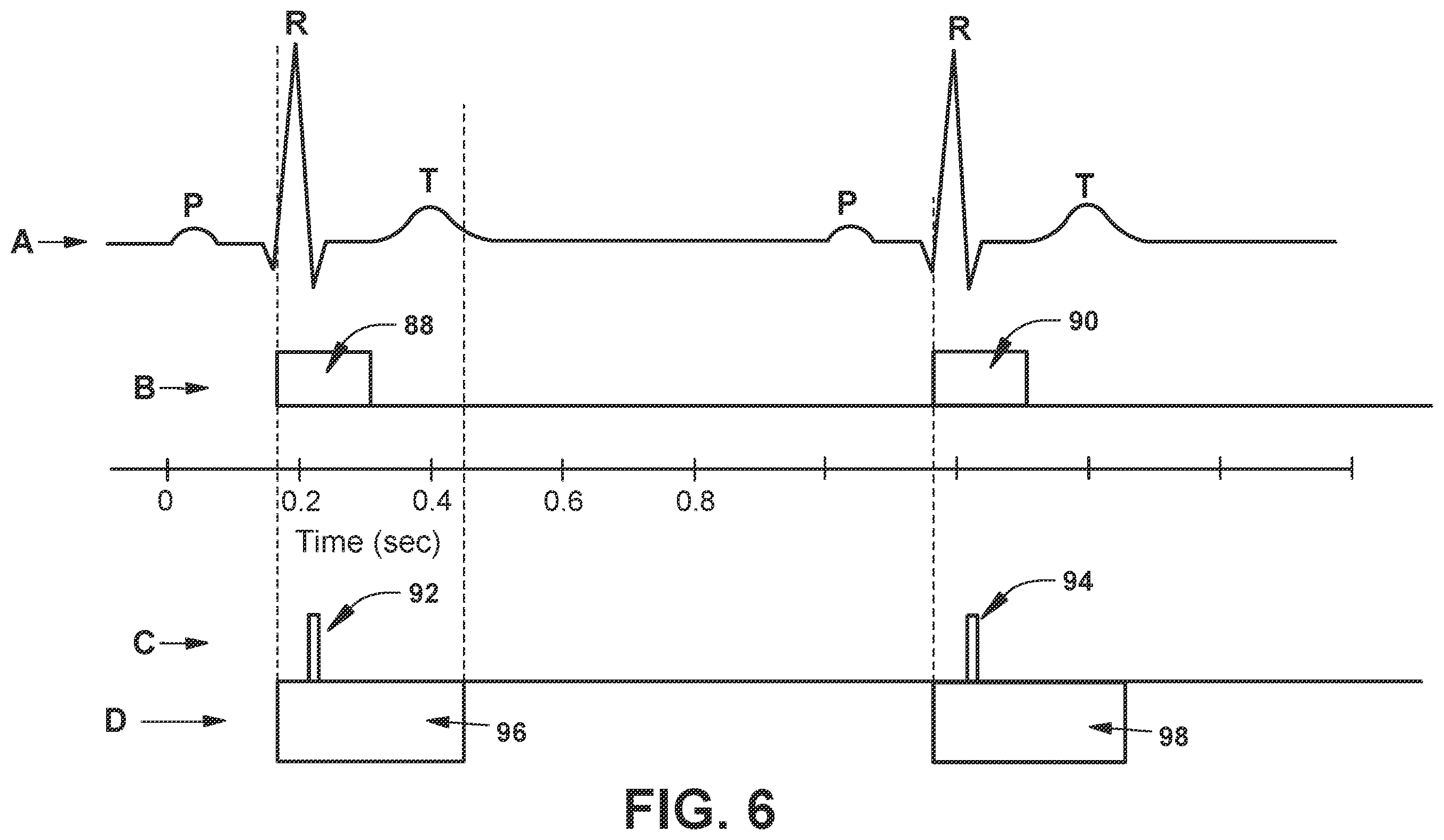 Patent US12564722 Figure 7 – System and method for synchronizing energy delivery to the cardiac rhythm