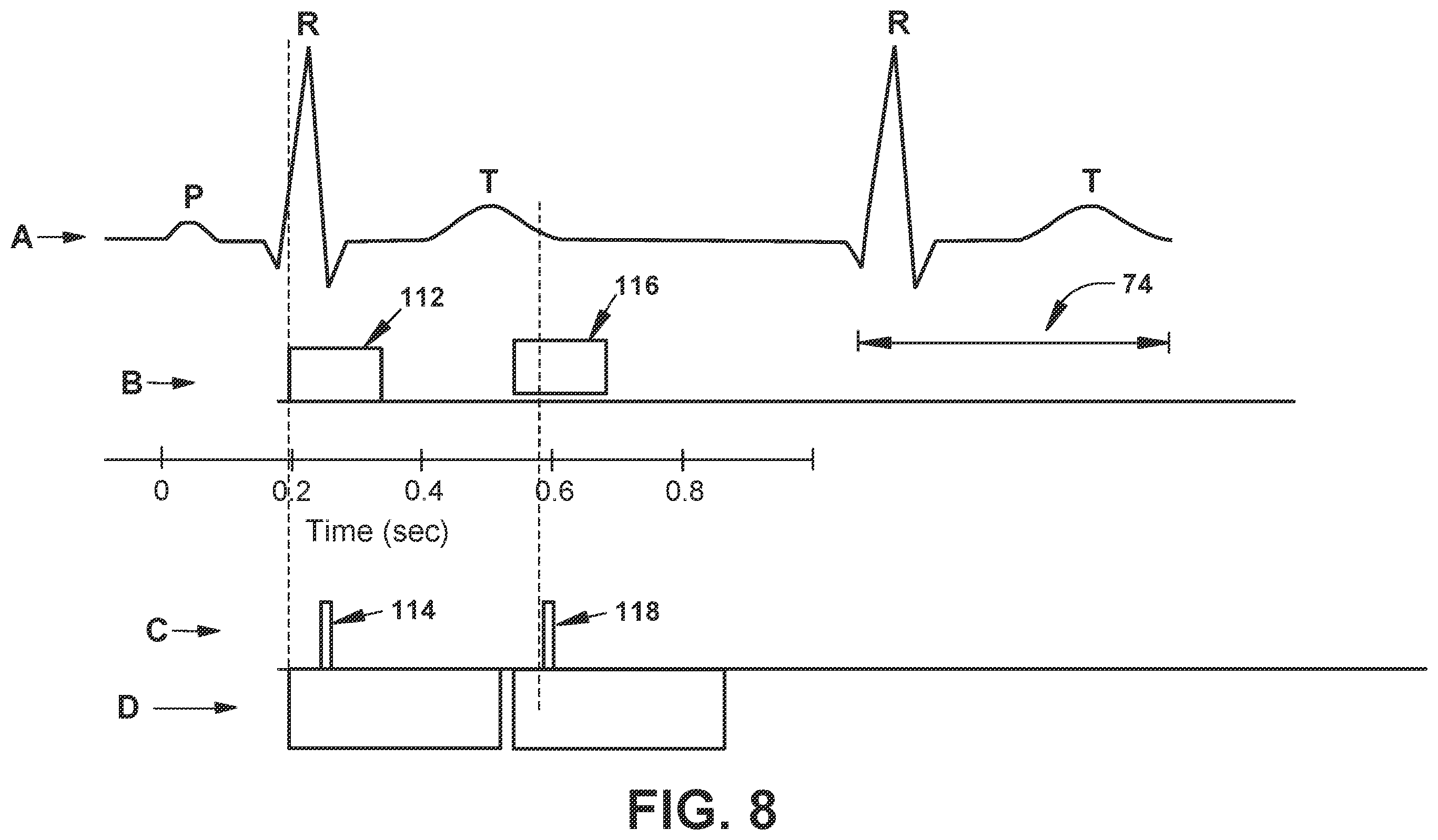 Patent US12564722 Figure 9 – System and method for synchronizing energy delivery to the cardiac rhythm