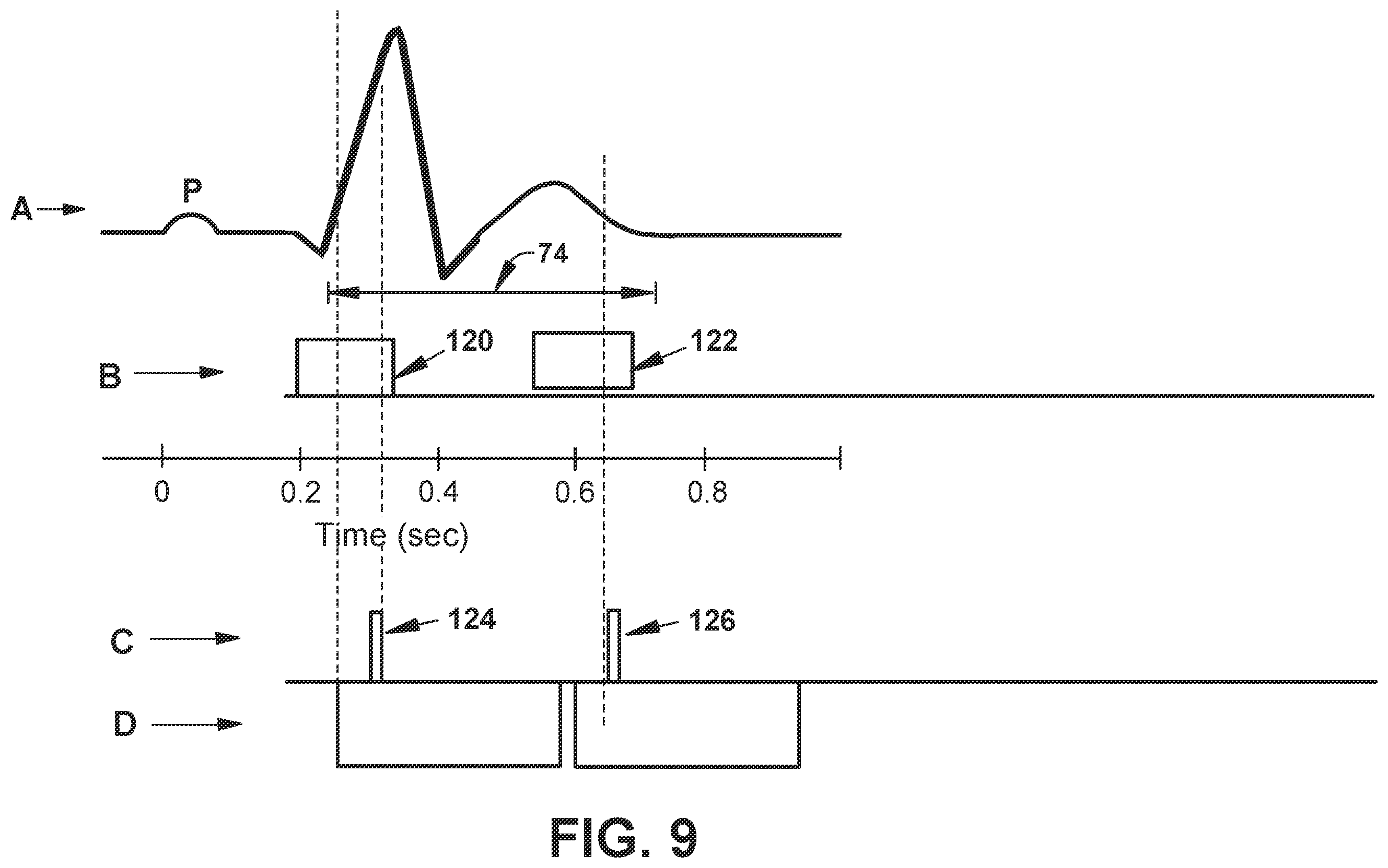 Patent US12564722 Figure 10 – System and method for synchronizing energy delivery to the cardiac rhythm