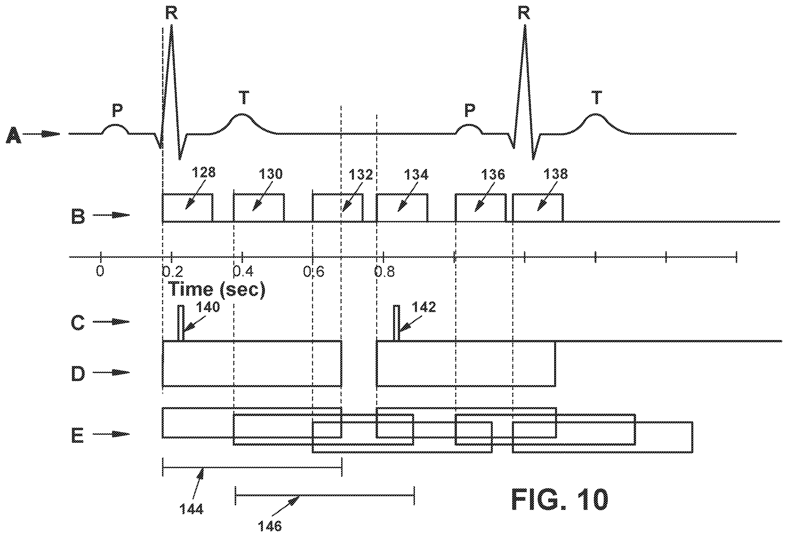 Patent US12564722 Figure 11 – System and method for synchronizing energy delivery to the cardiac rhythm