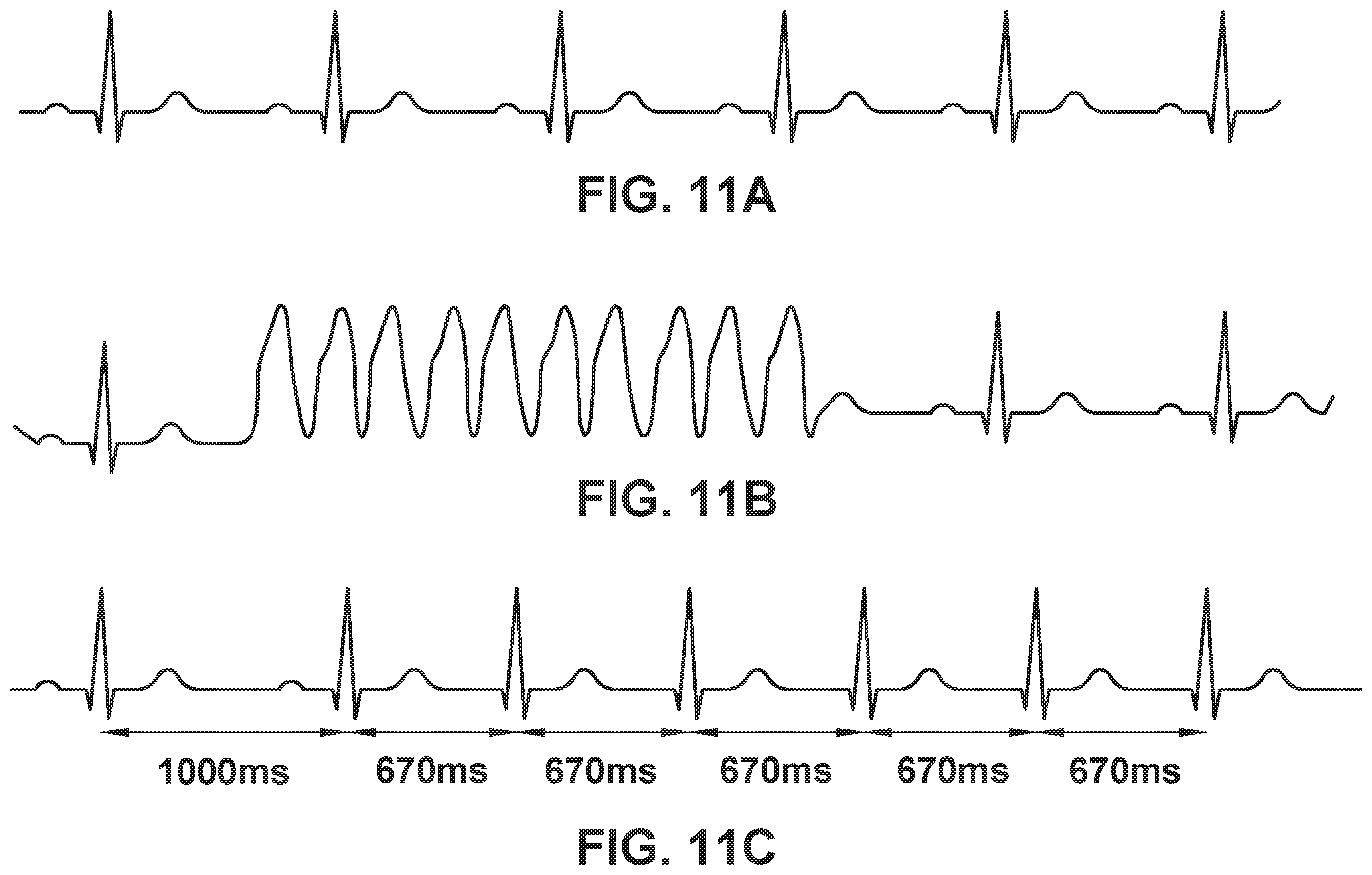 Patent US12564722 Figure 12 – System and method for synchronizing energy delivery to the cardiac rhythm