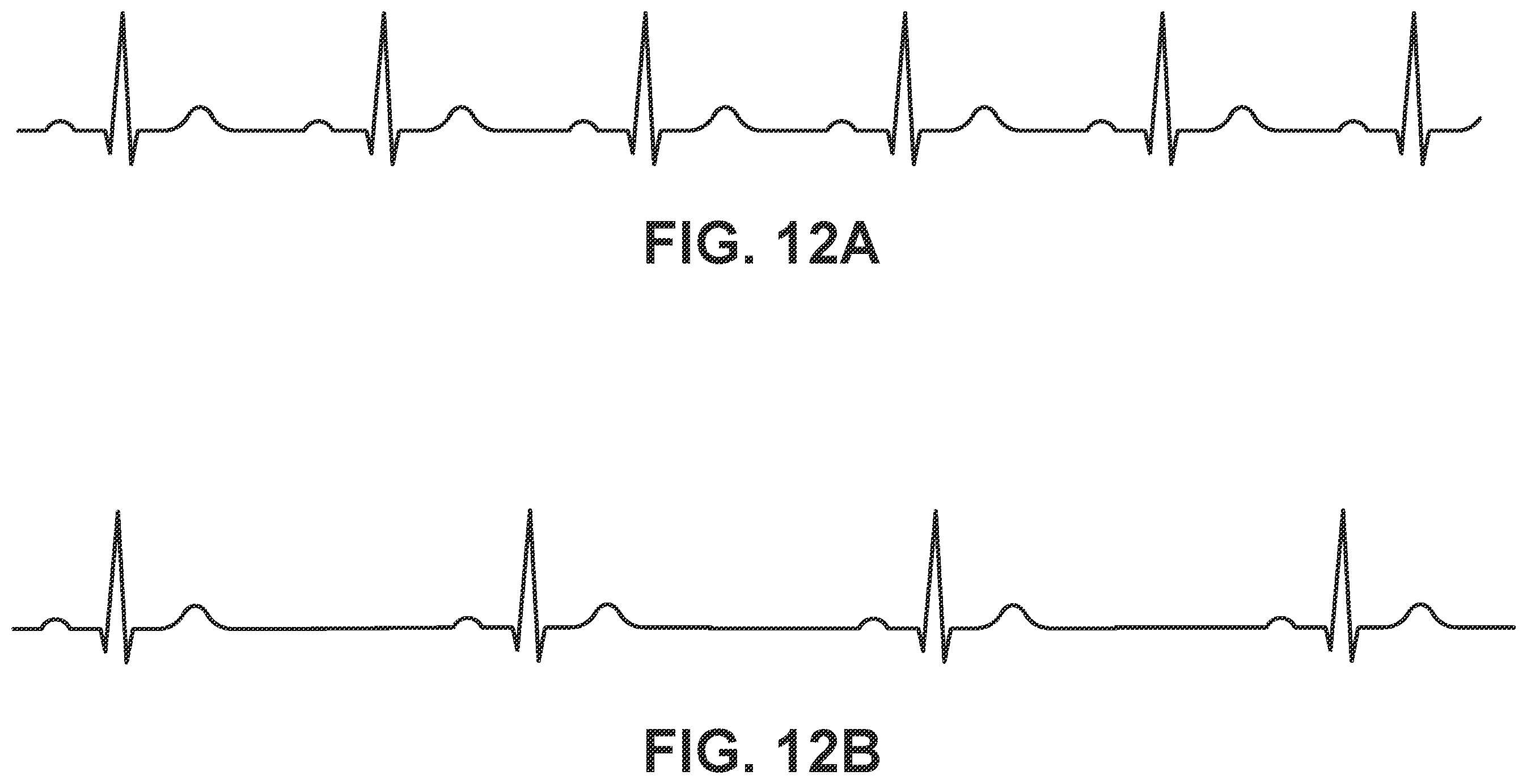 Patent US12564722 Figure 13 – System and method for synchronizing energy delivery to the cardiac rhythm
