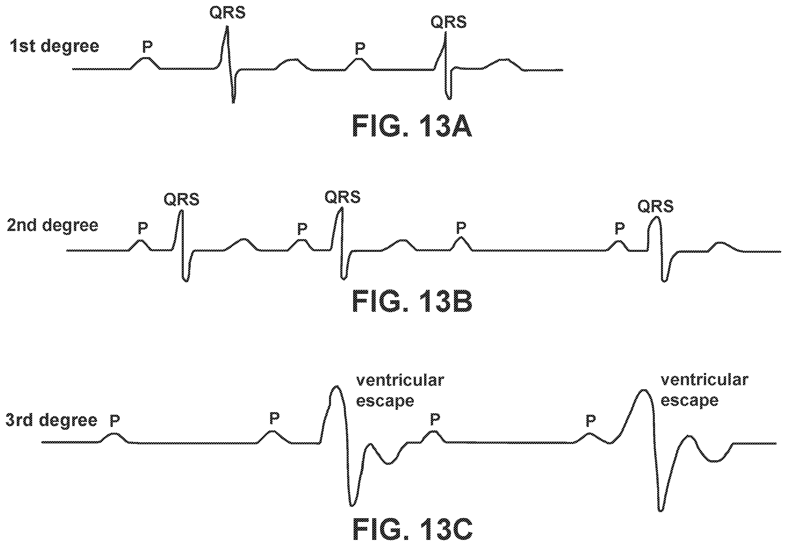 Patent US12564722 Figure 14 – System and method for synchronizing energy delivery to the cardiac rhythm