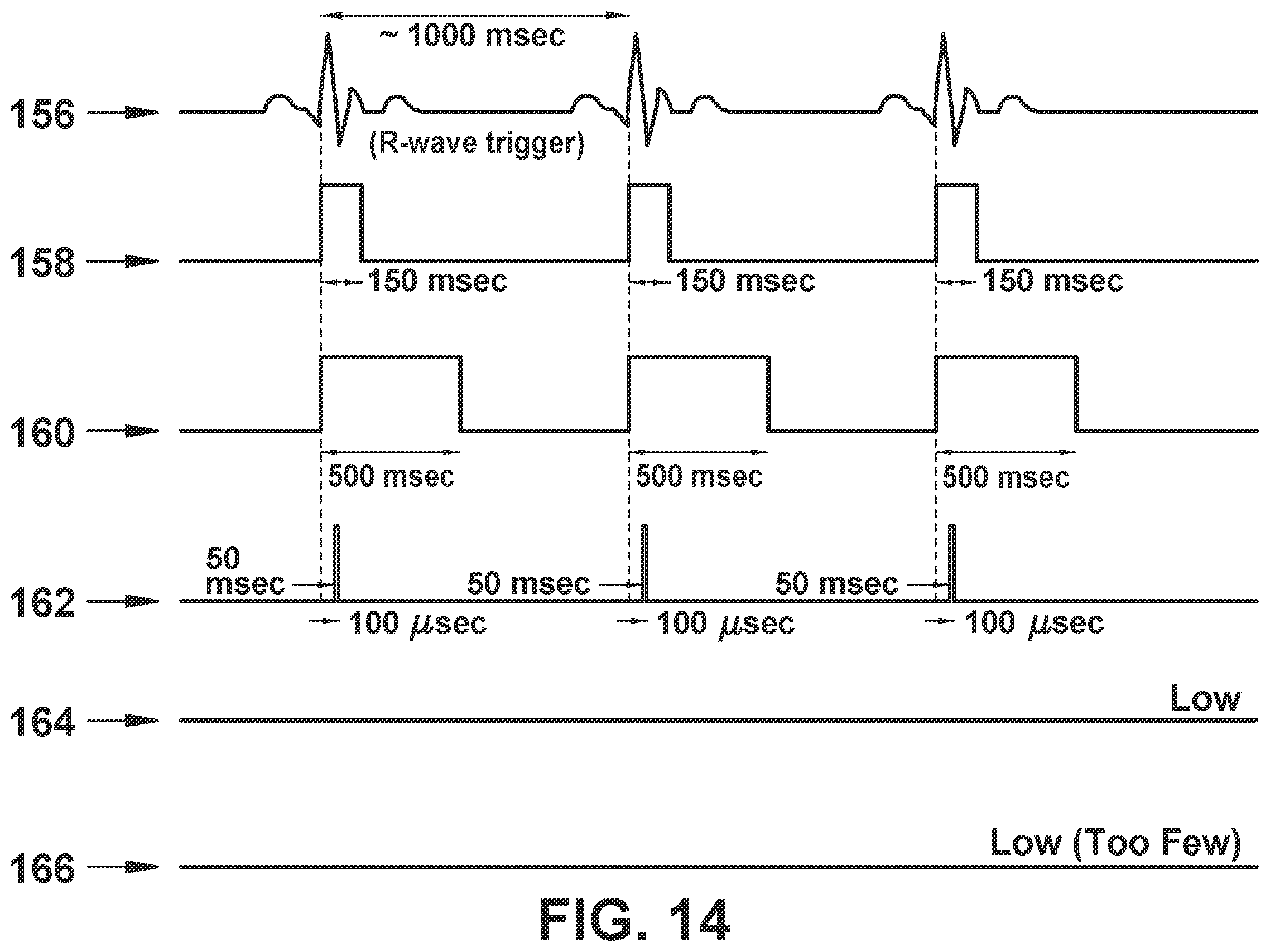 Patent US12564722 Figure 15 – System and method for synchronizing energy delivery to the cardiac rhythm