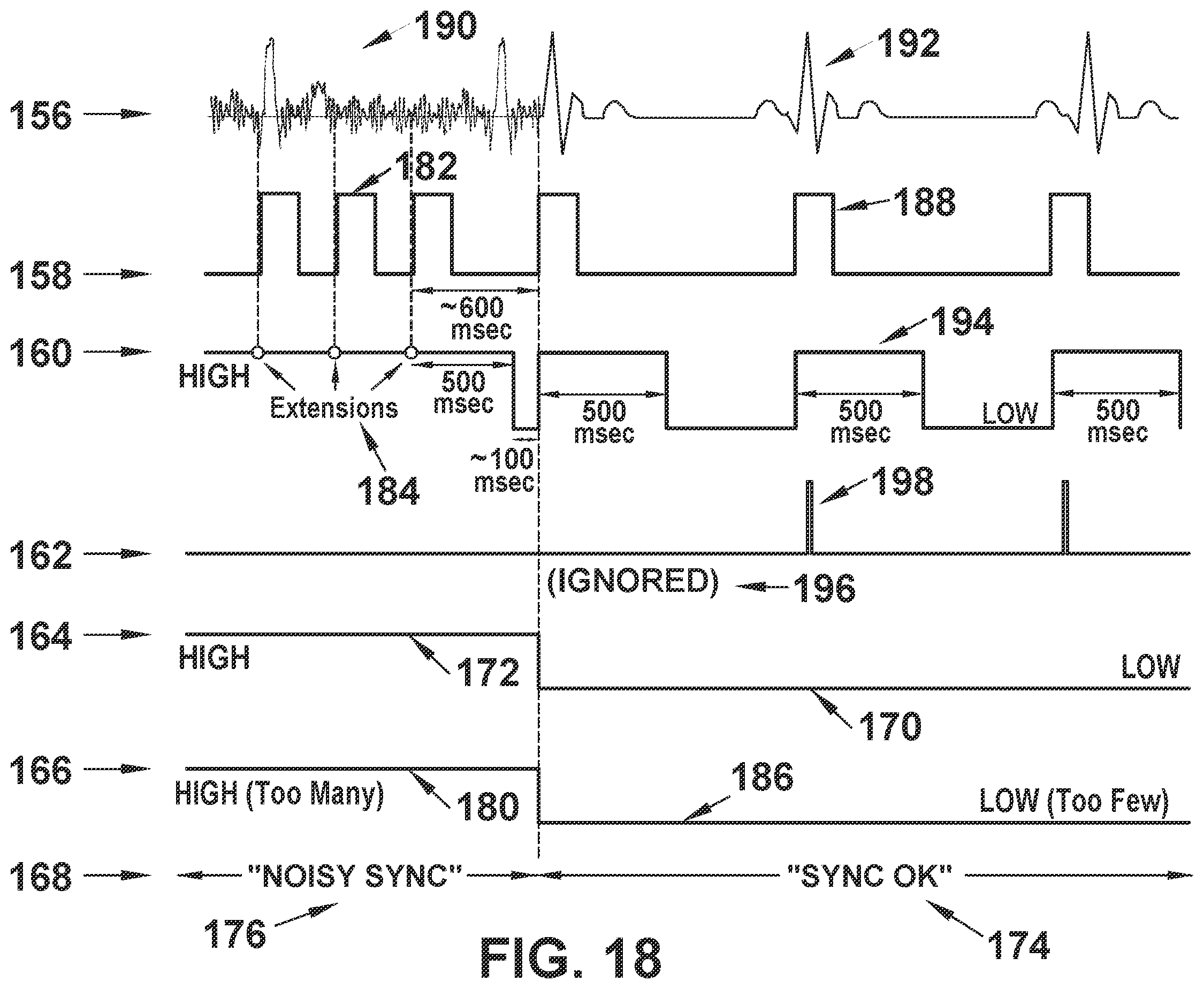 Patent US12564722 Figure 19 – System and method for synchronizing energy delivery to the cardiac rhythm
