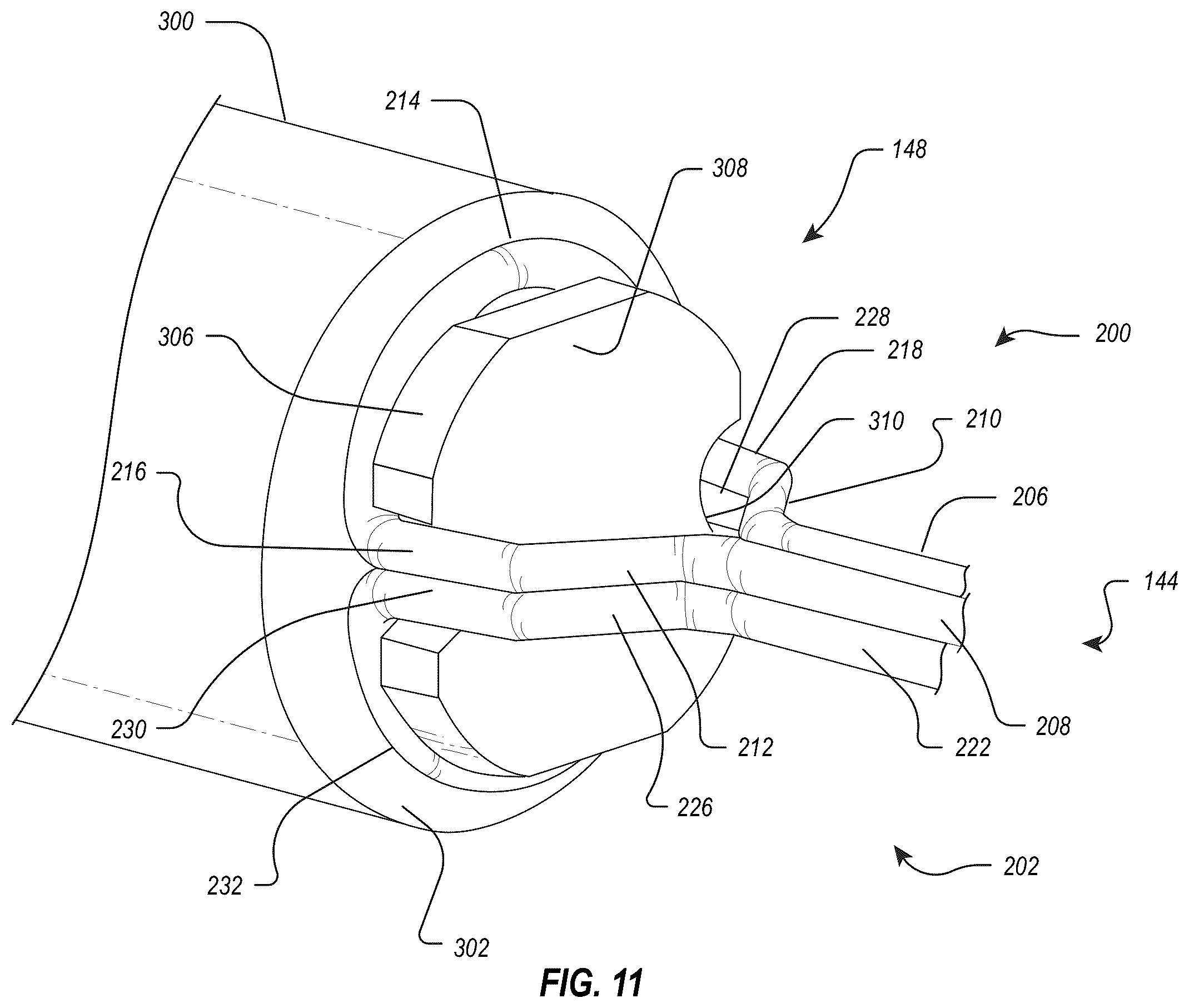 Patent US12564723 Figure 11 – Implant delivery and retrieval systems and methods
