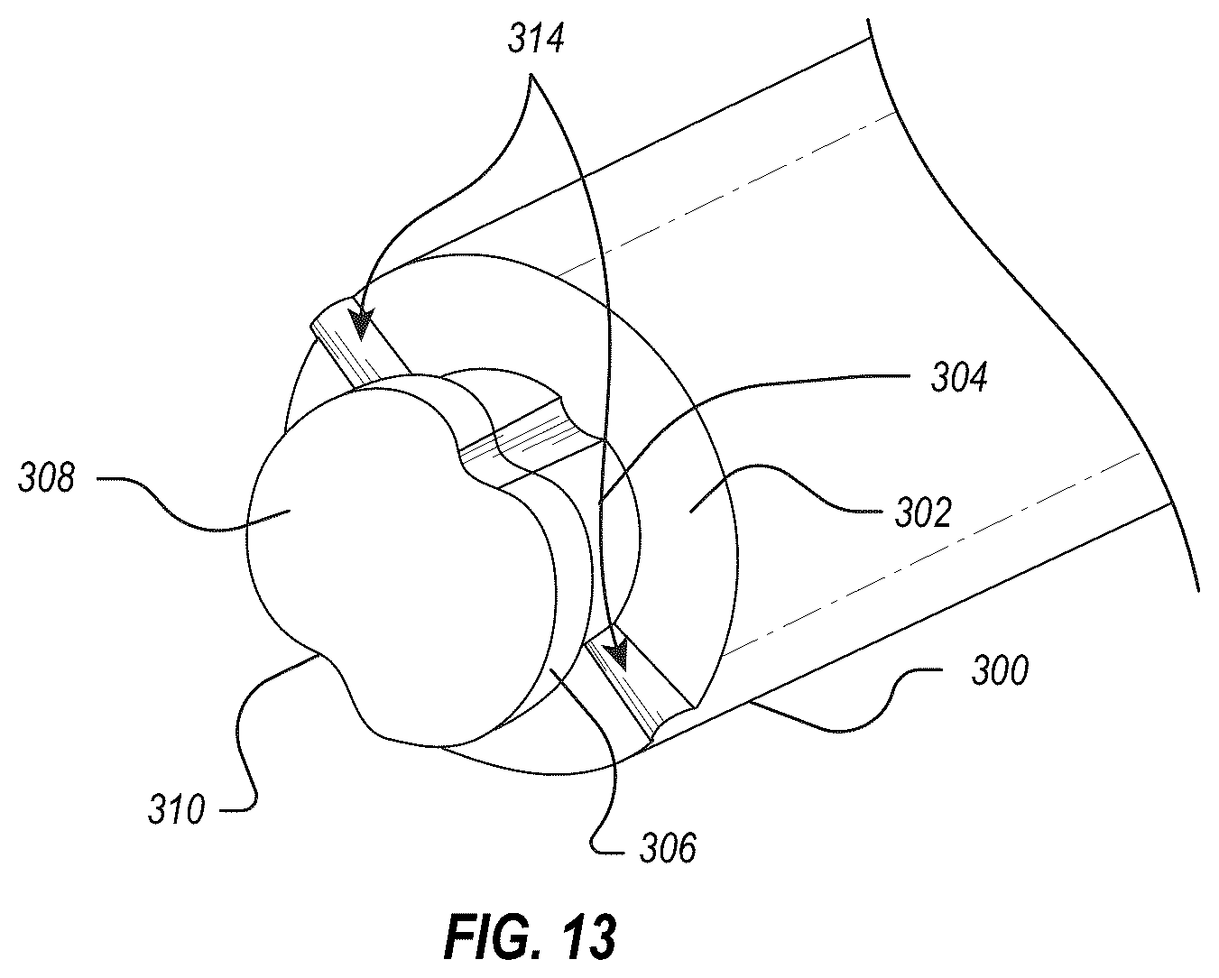 Patent US12564723 Figure 13 – Implant delivery and retrieval systems and methods