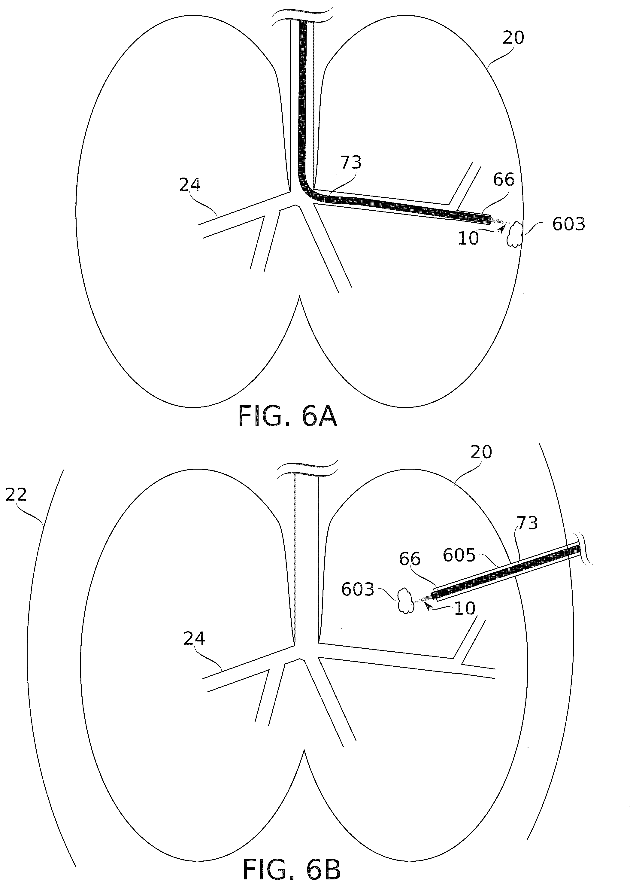 Patent US12564725 Figure 8 – Treatment of internal spaces using plasma generating device