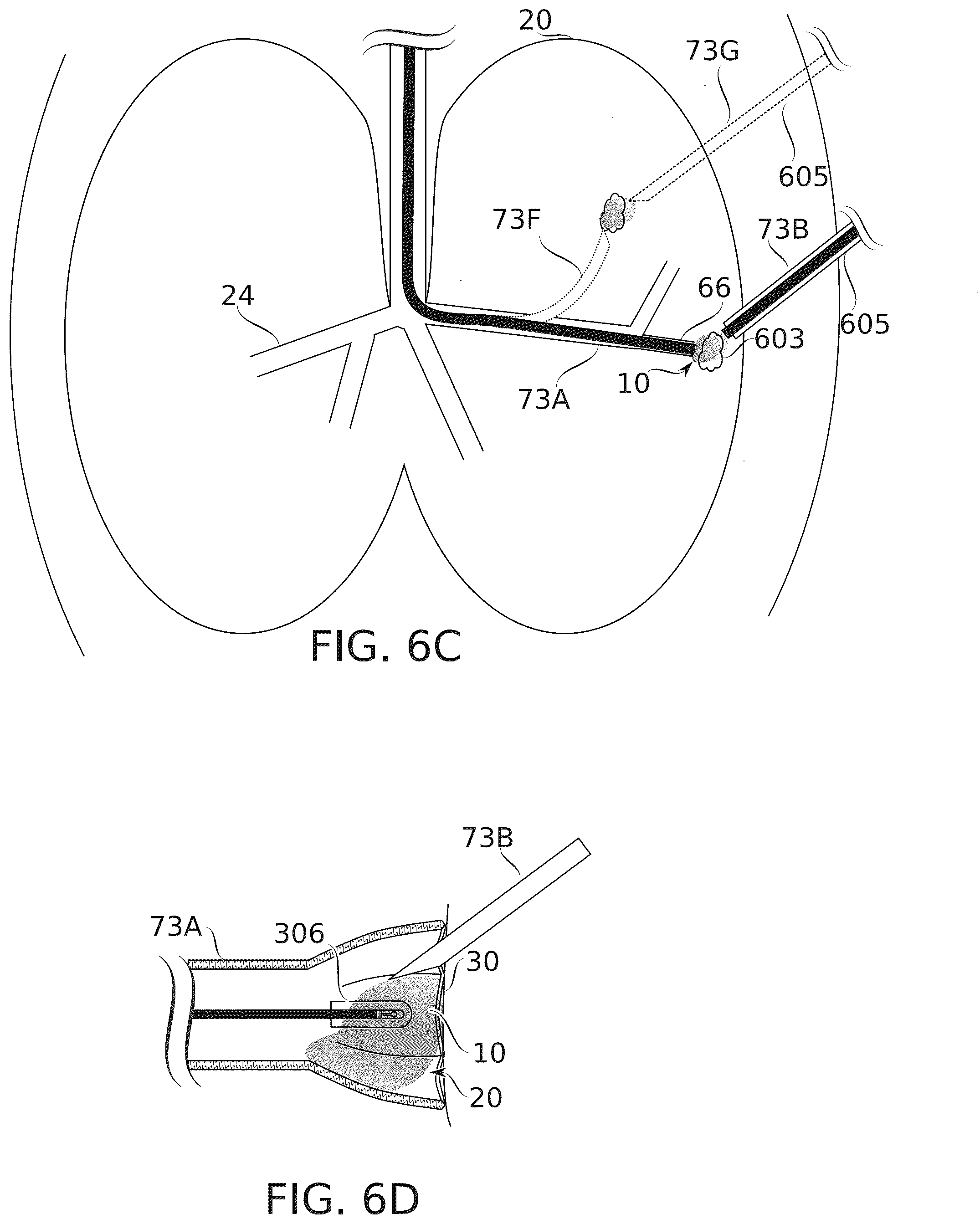 Patent US12564725 Figure 9 – Treatment of internal spaces using plasma generating device