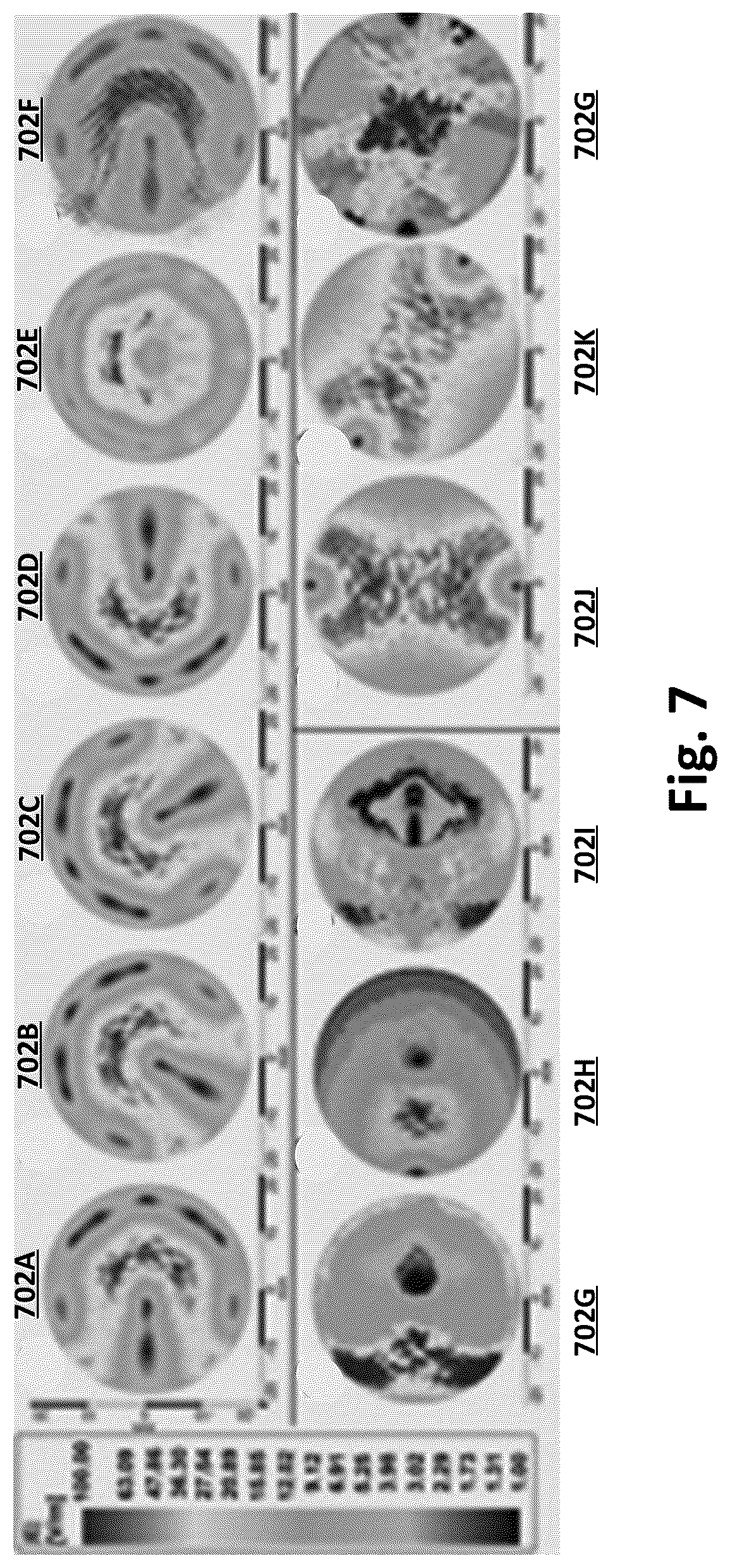 Patent US12564727 Figure 7 – System and method for multi-coil steerable and selectively focussed transcranial magnetic stimulation