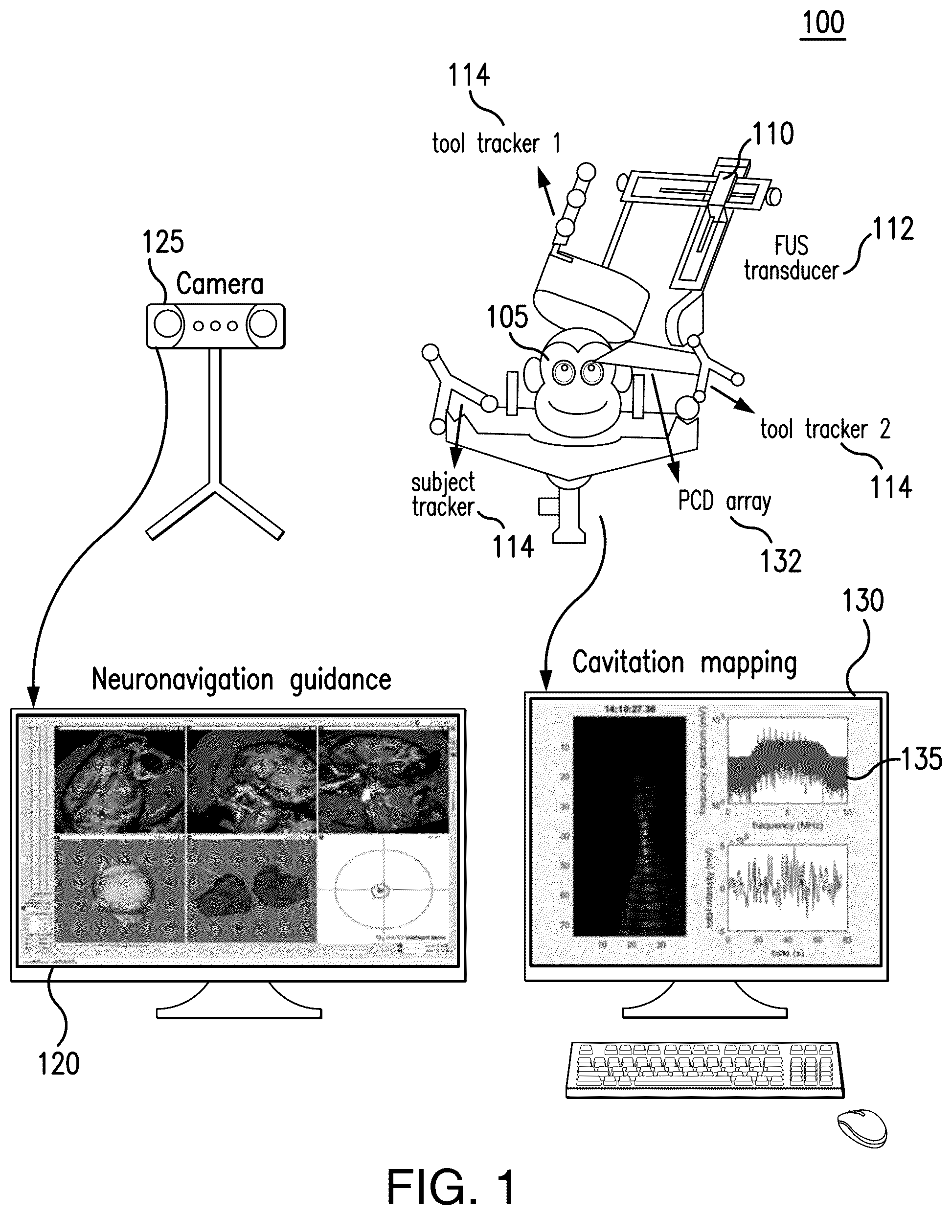 Patent US12564735 Figure 1 – Systems and methods for modulation and mapping of brain tissue using an ultrasound assembly