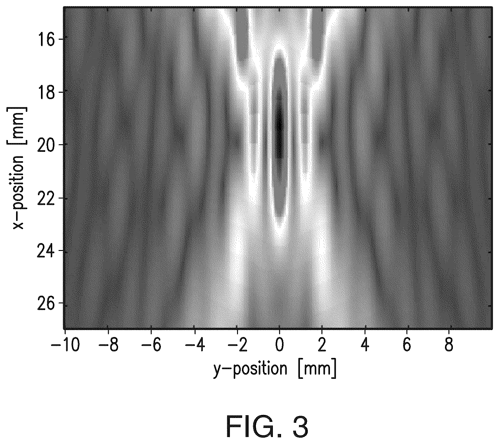Patent US12564735 Figure 3 – Systems and methods for modulation and mapping of brain tissue using an ultrasound assembly