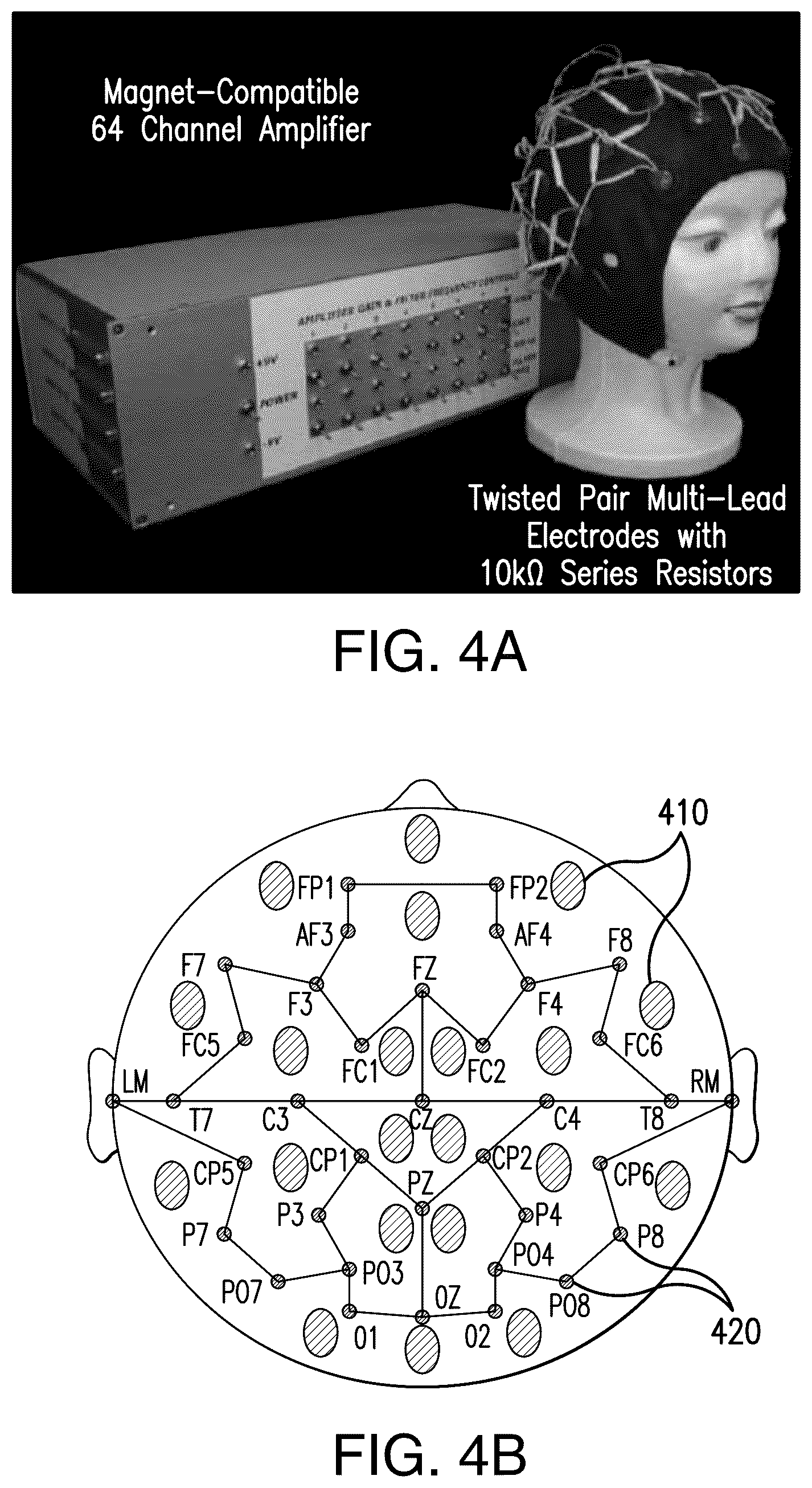 Patent US12564735 Figure 4 – Systems and methods for modulation and mapping of brain tissue using an ultrasound assembly