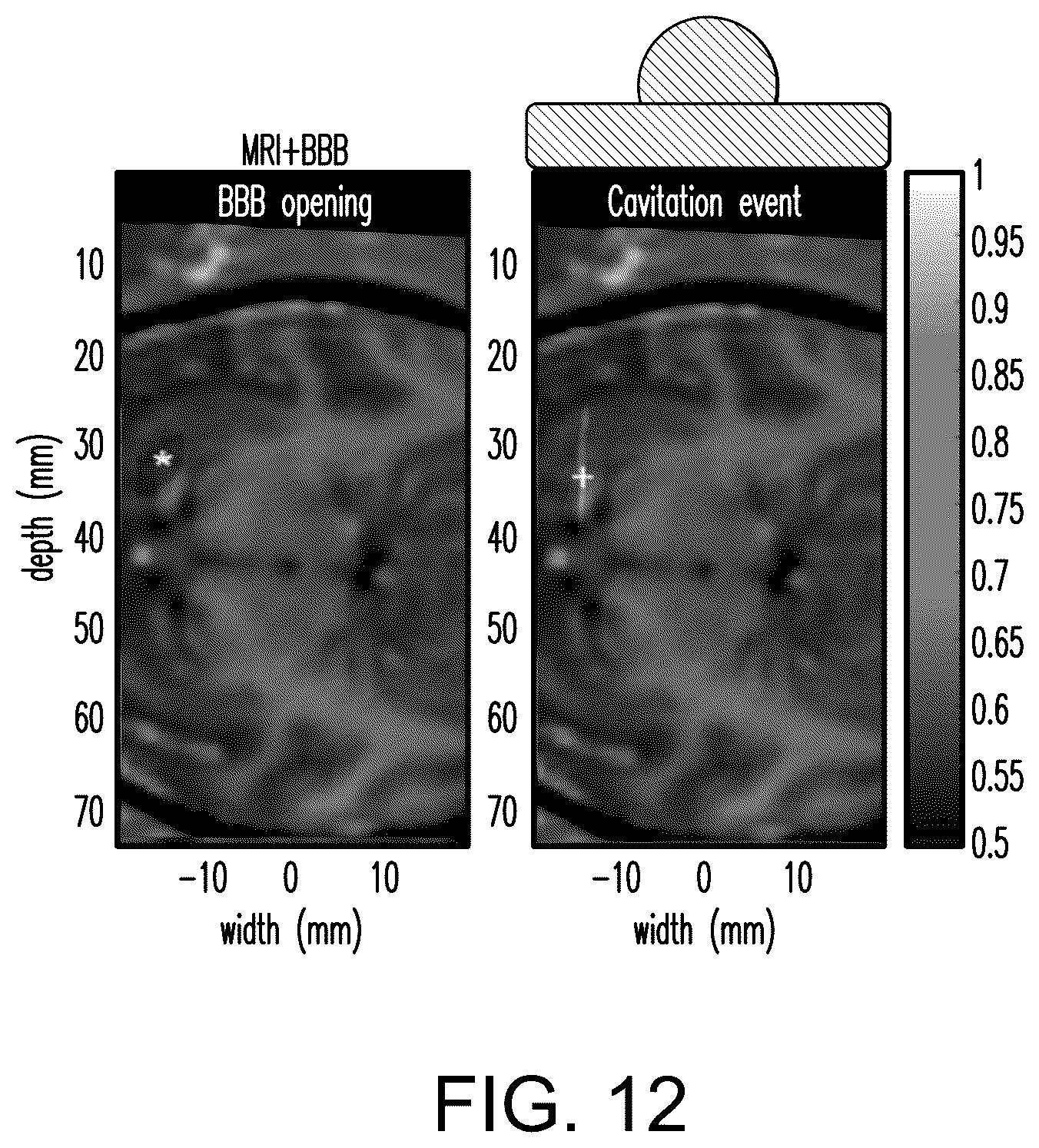 Patent US12564735 Figure 12 – Systems and methods for modulation and mapping of brain tissue using an ultrasound assembly