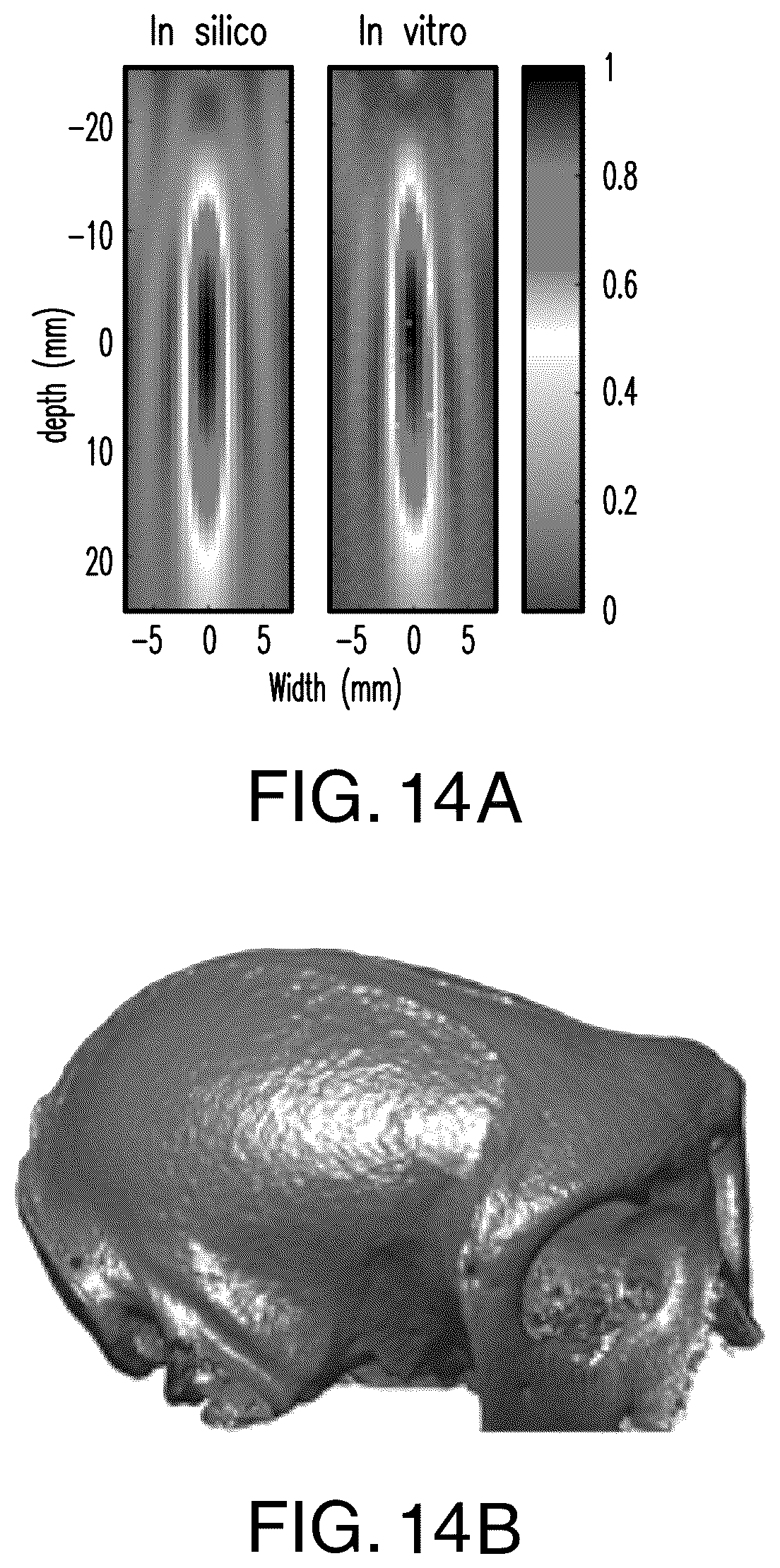 Patent US12564735 Figure 14 – Systems and methods for modulation and mapping of brain tissue using an ultrasound assembly