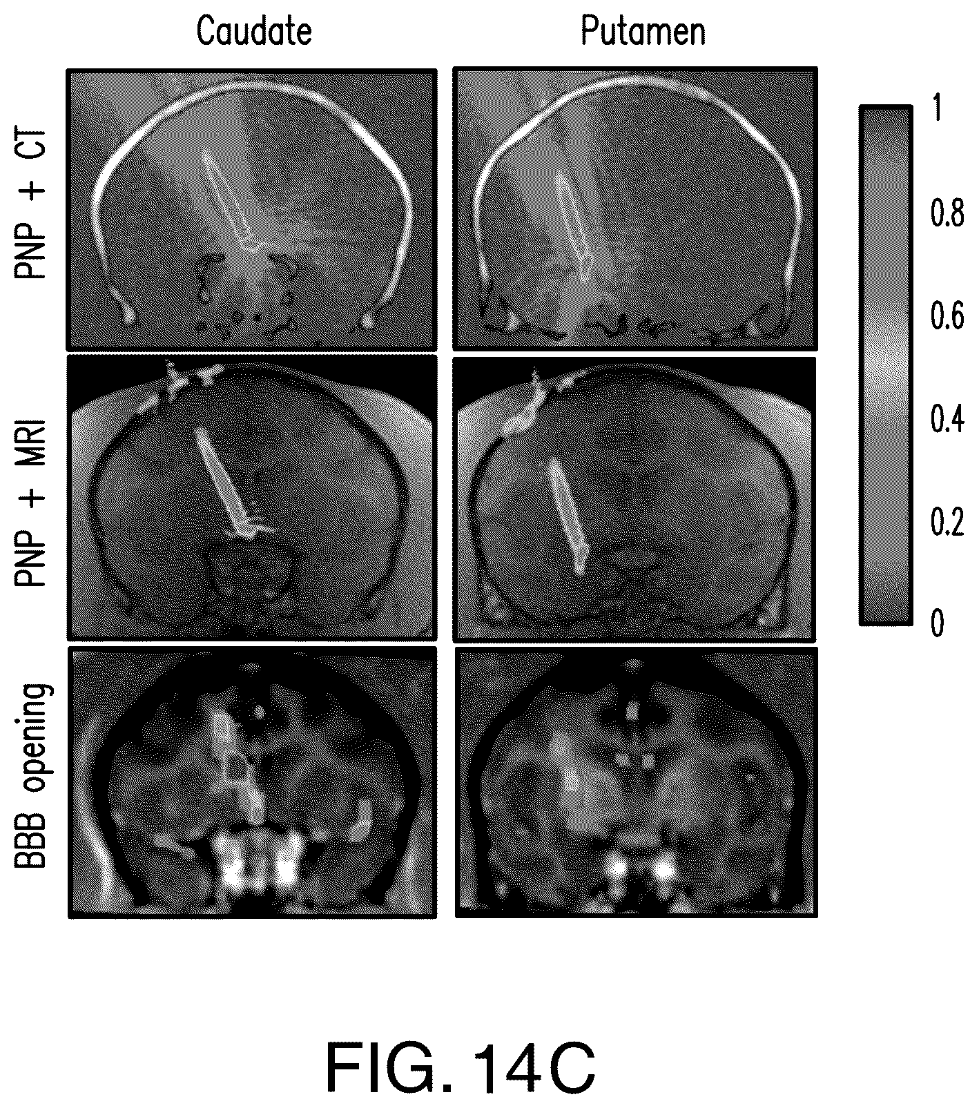 Patent US12564735 Figure 15 – Systems and methods for modulation and mapping of brain tissue using an ultrasound assembly