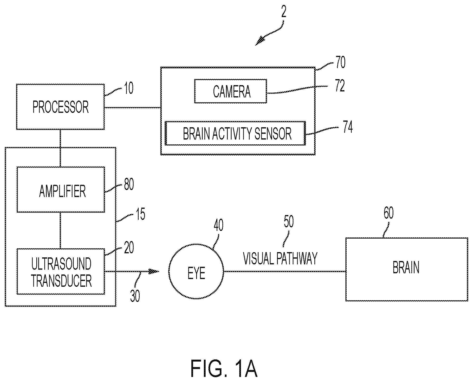 Patent US12564736 Figure 1 – Non-invasive ultrasound neuromodulation for vision restoration from retinal diseases