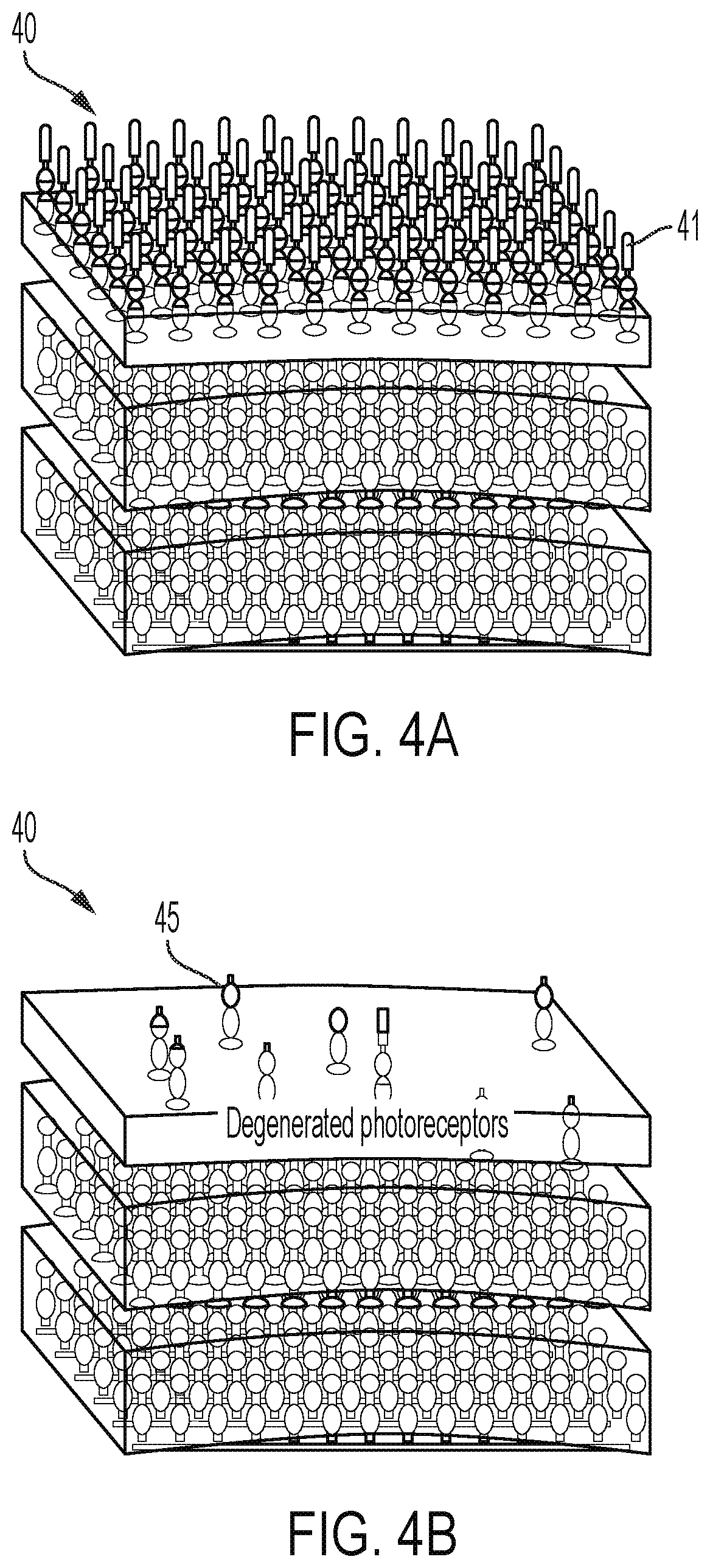 Patent US12564736 Figure 5 – Non-invasive ultrasound neuromodulation for vision restoration from retinal diseases