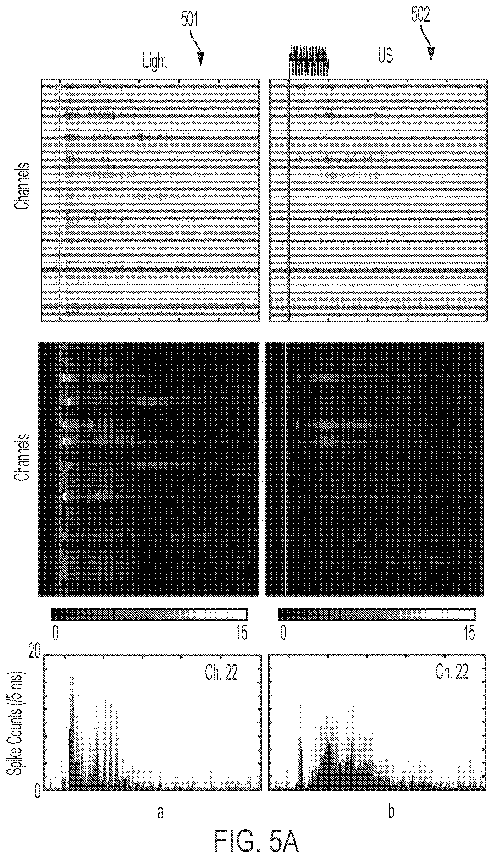 Patent US12564736 Figure 6 – Non-invasive ultrasound neuromodulation for vision restoration from retinal diseases