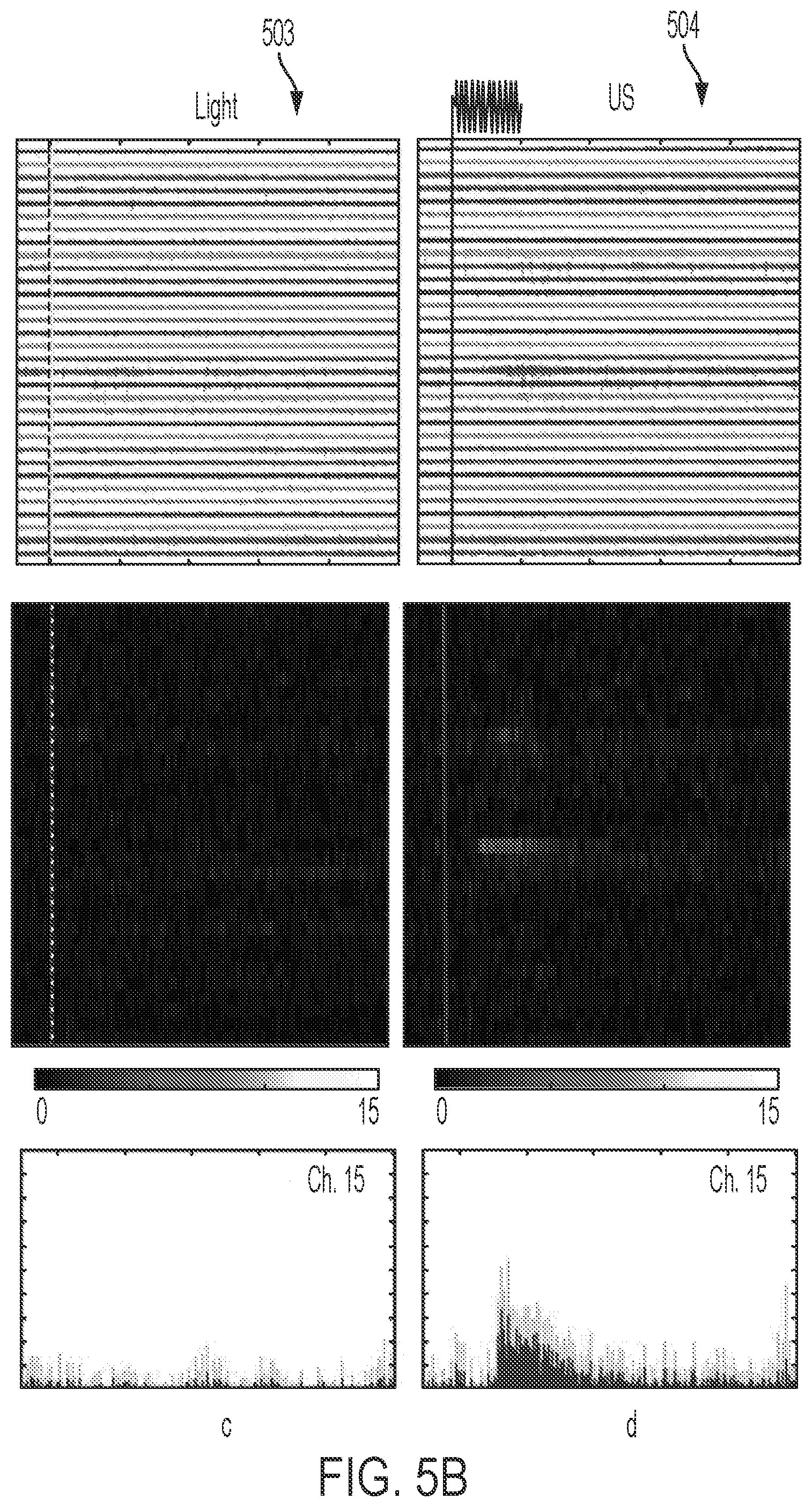 Patent US12564736 Figure 7 – Non-invasive ultrasound neuromodulation for vision restoration from retinal diseases