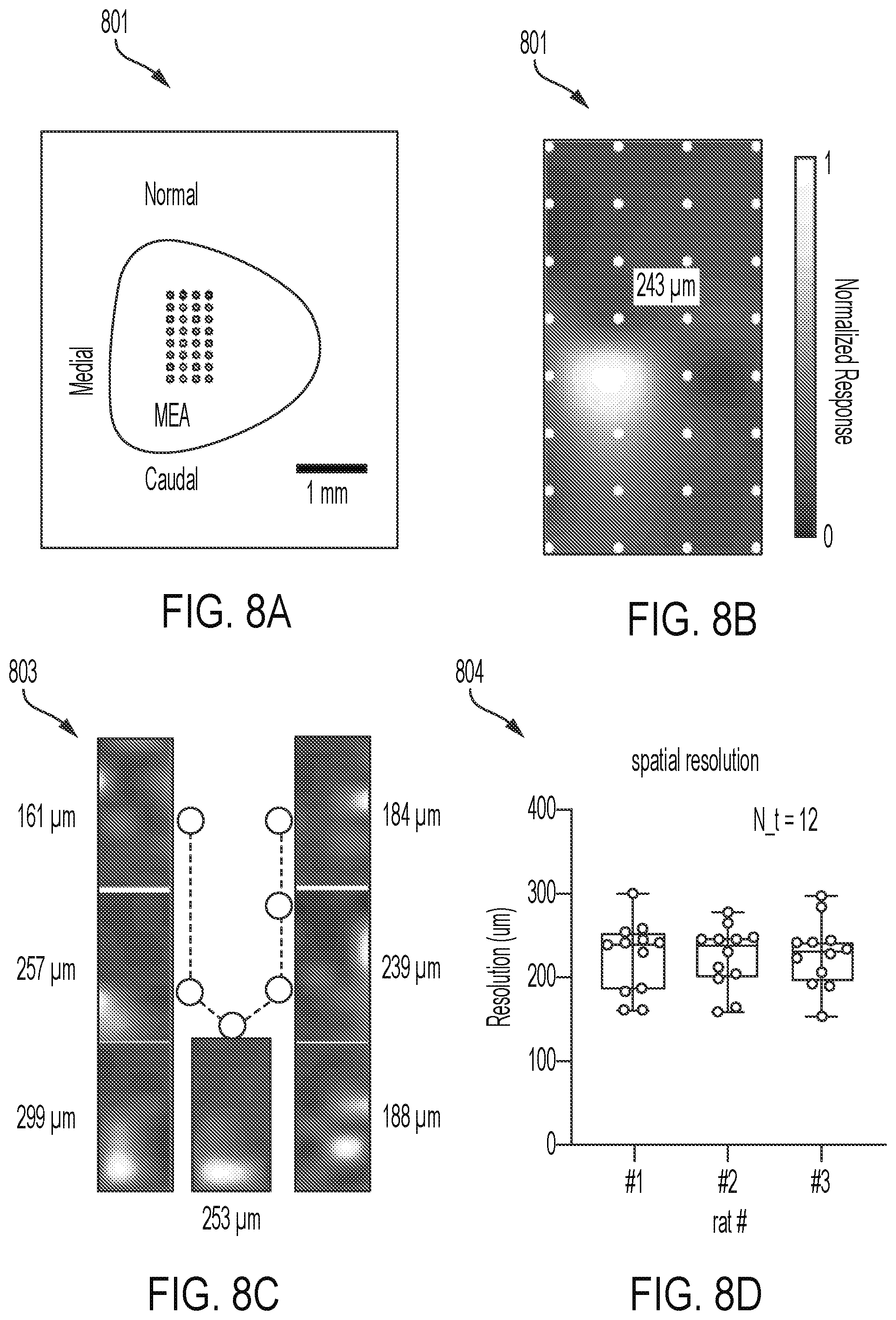 Patent US12564736 Figure 11 – Non-invasive ultrasound neuromodulation for vision restoration from retinal diseases