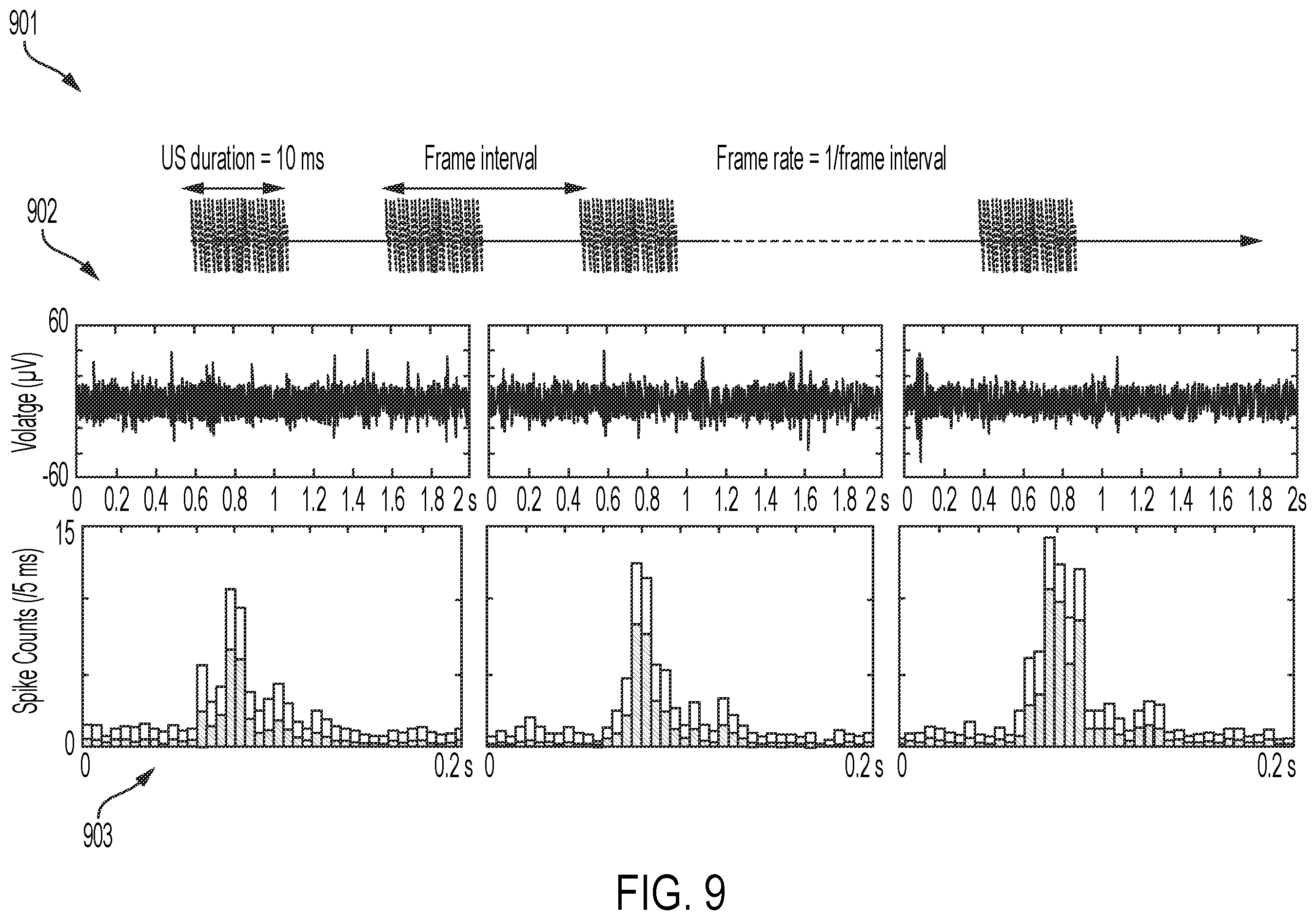Patent US12564736 Figure 12 – Non-invasive ultrasound neuromodulation for vision restoration from retinal diseases
