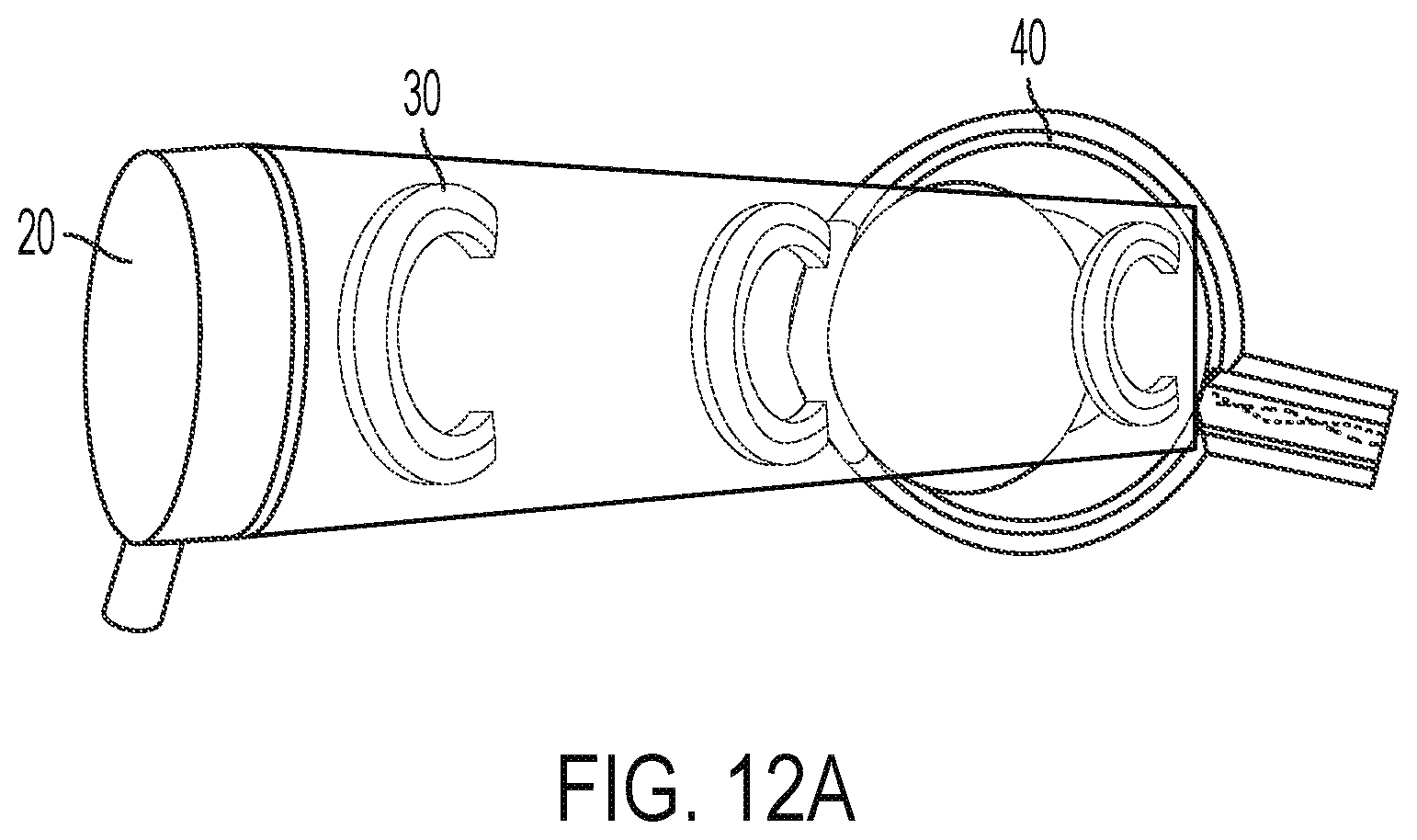 Patent US12564736 Figure 15 – Non-invasive ultrasound neuromodulation for vision restoration from retinal diseases