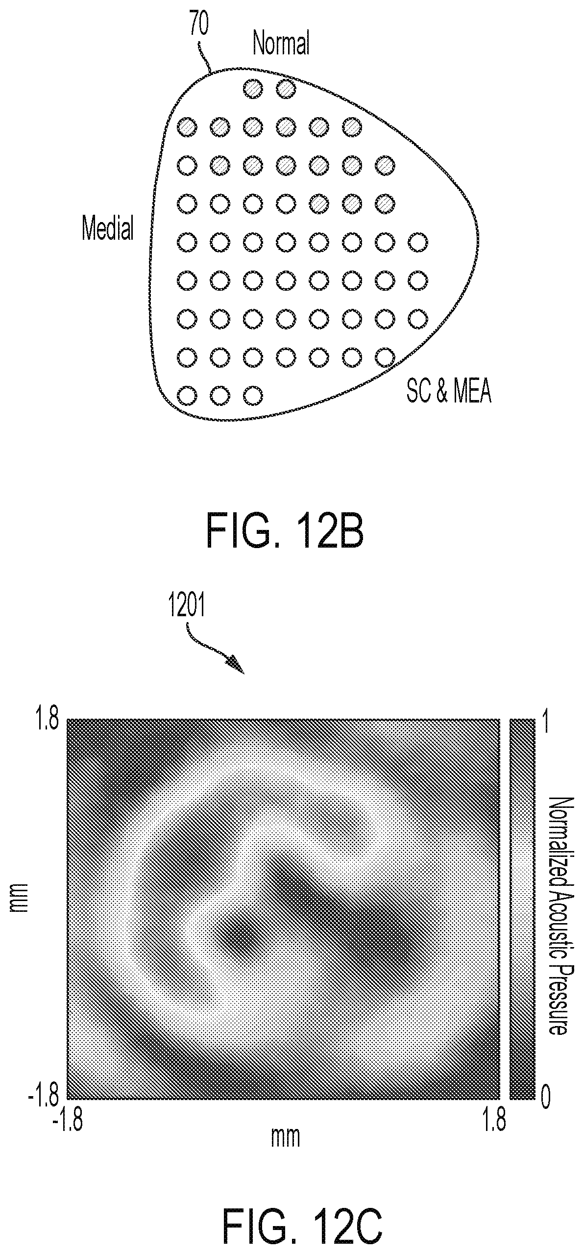 Patent US12564736 Figure 16 – Non-invasive ultrasound neuromodulation for vision restoration from retinal diseases