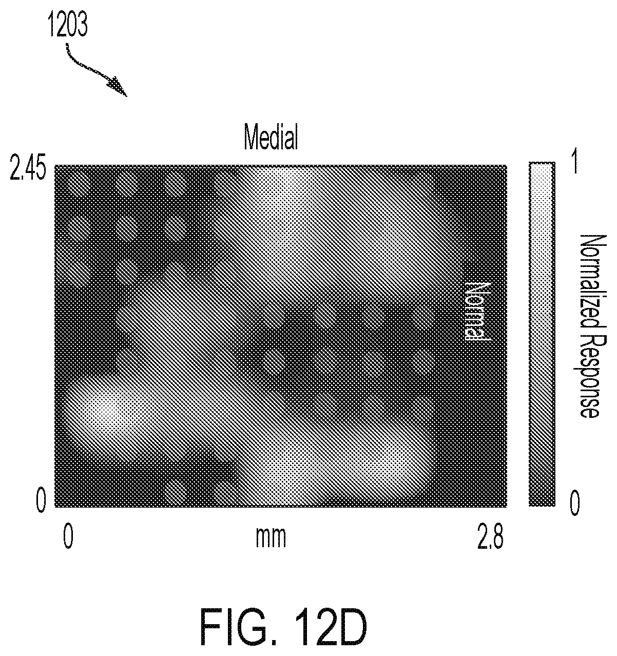 Patent US12564736 Figure 17 – Non-invasive ultrasound neuromodulation for vision restoration from retinal diseases