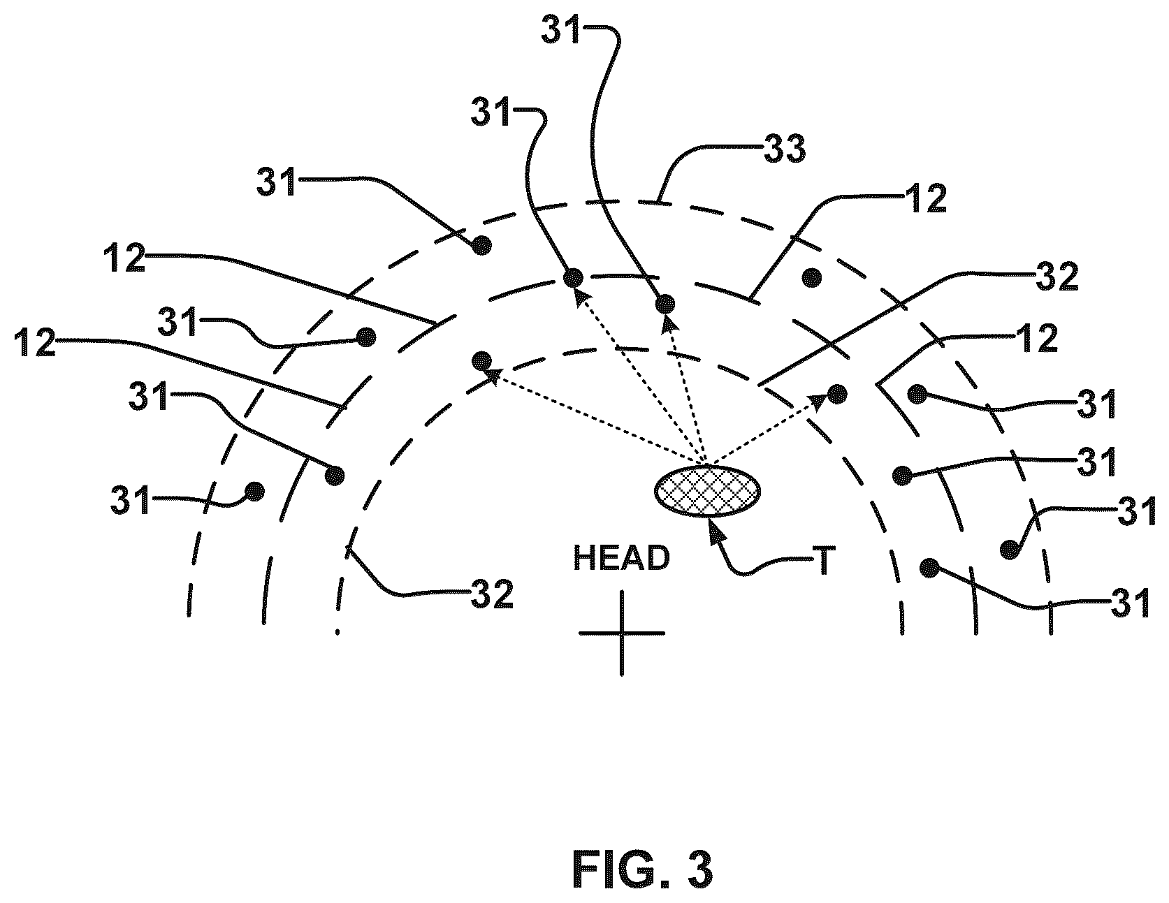 Patent US12564737 Figure 3 – Rapid calculation of parameters for delivering ultrasound energy to selected locations in the brain