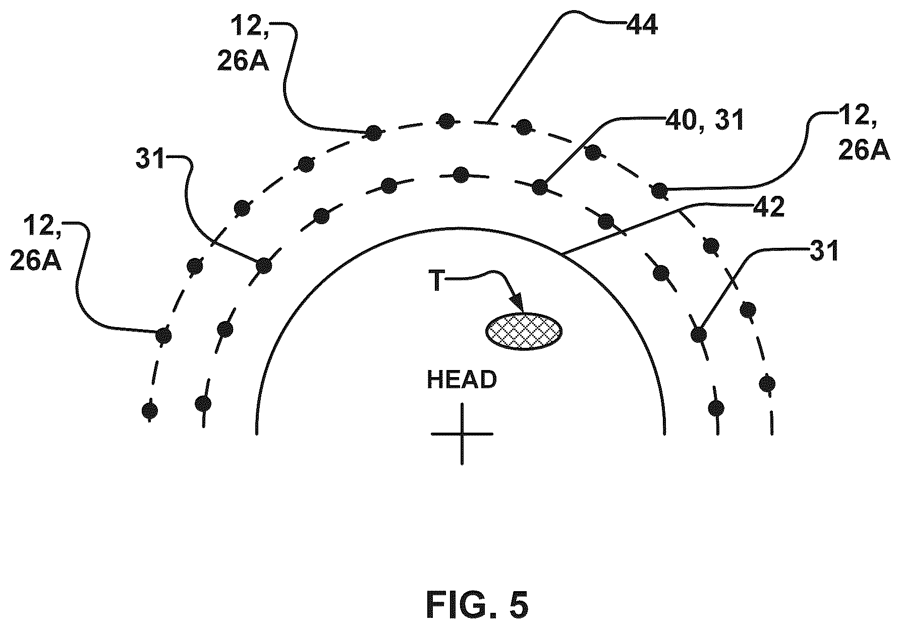 Patent US12564737 Figure 6 – Rapid calculation of parameters for delivering ultrasound energy to selected locations in the brain