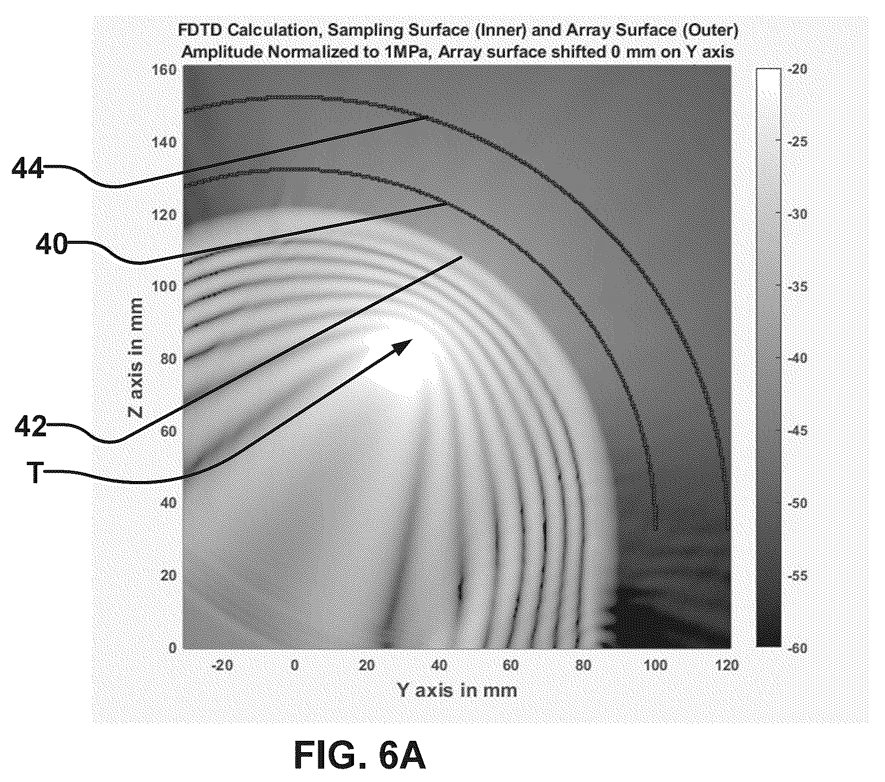 Patent US12564737 Figure 7 – Rapid calculation of parameters for delivering ultrasound energy to selected locations in the brain