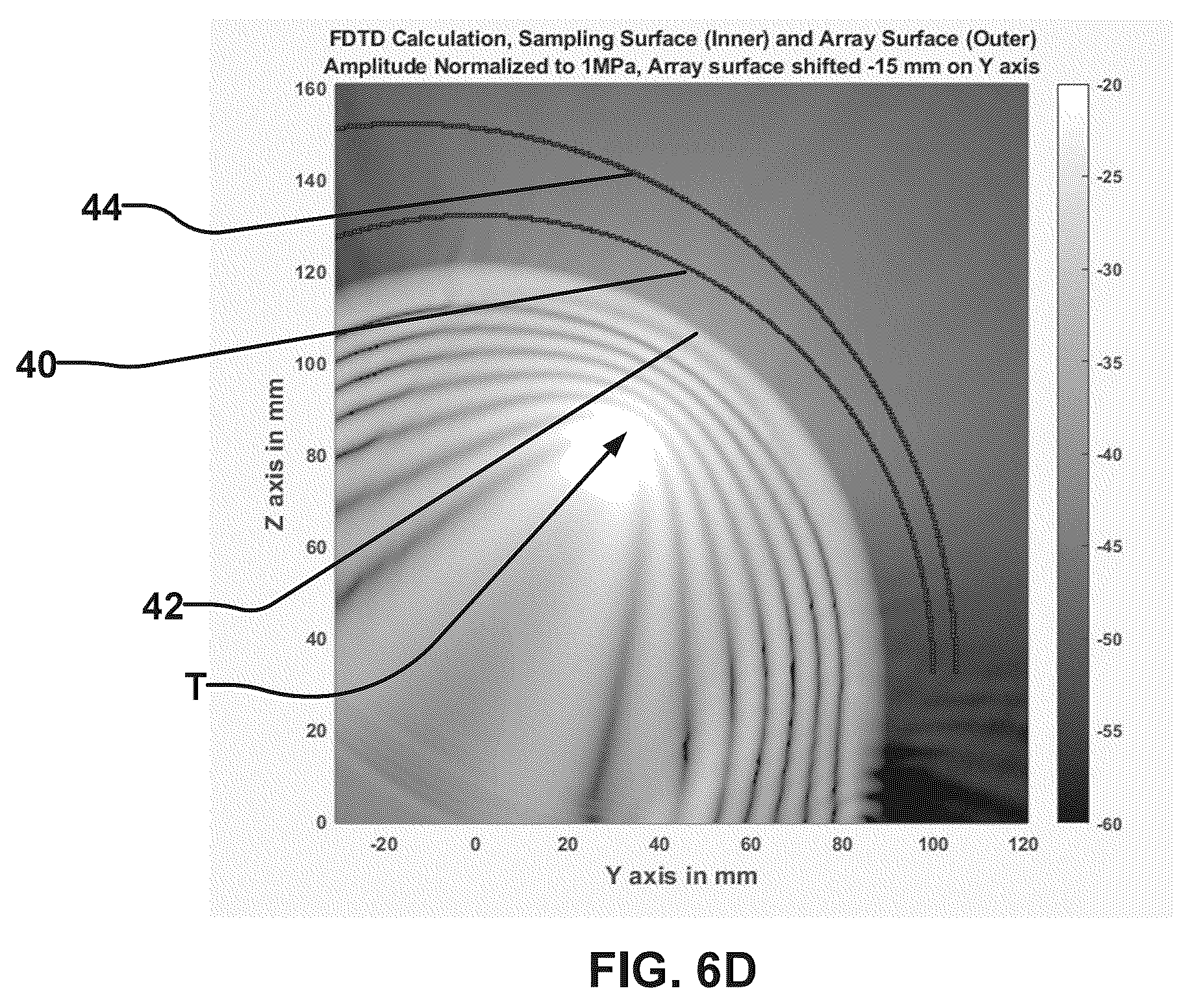 Patent US12564737 Figure 9 – Rapid calculation of parameters for delivering ultrasound energy to selected locations in the brain